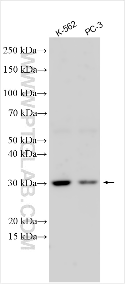 Western Blot (WB) analysis of various lysates using APIP Polyclonal antibody (12089-2-AP)