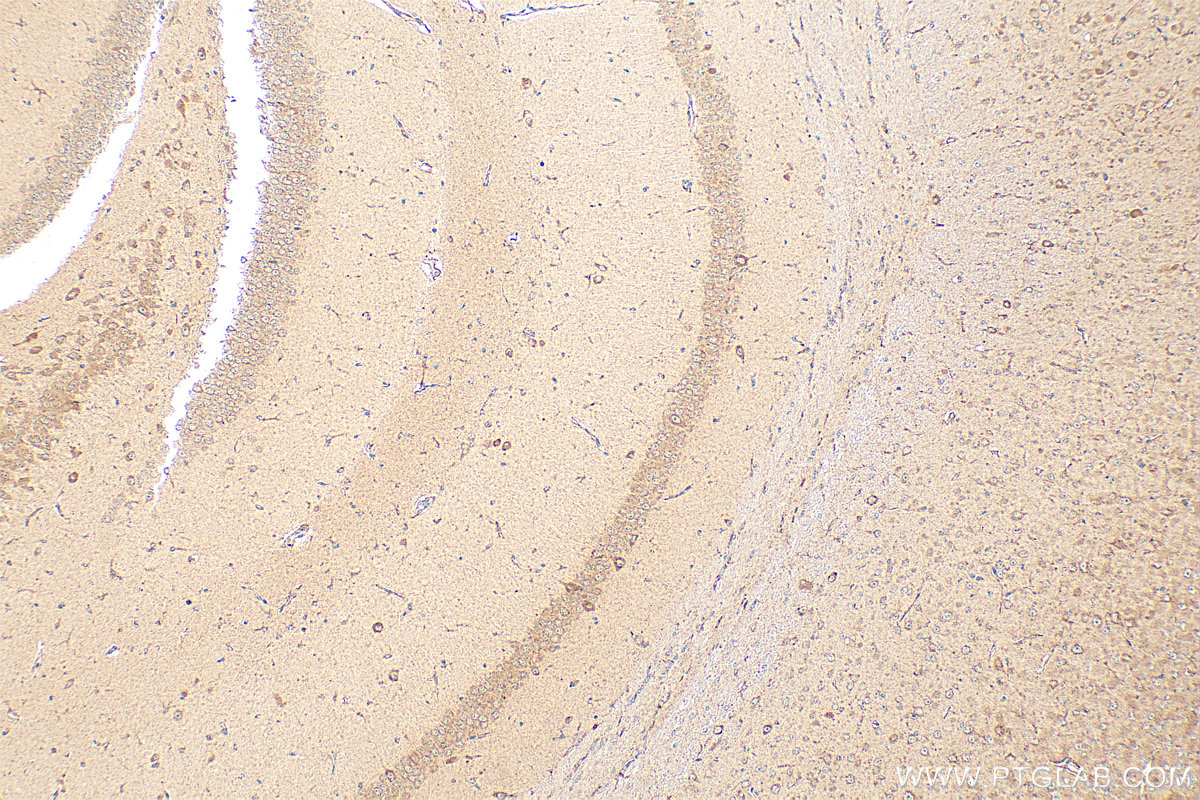 Immunohistochemistry (IHC) staining of mouse brain tissue using APLP2 Polyclonal antibody (15041-1-AP)