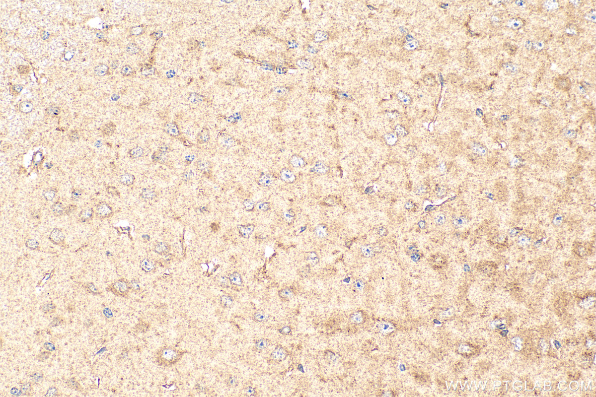 Immunohistochemistry (IHC) staining of mouse brain tissue using APLP2 Polyclonal antibody (15041-1-AP)