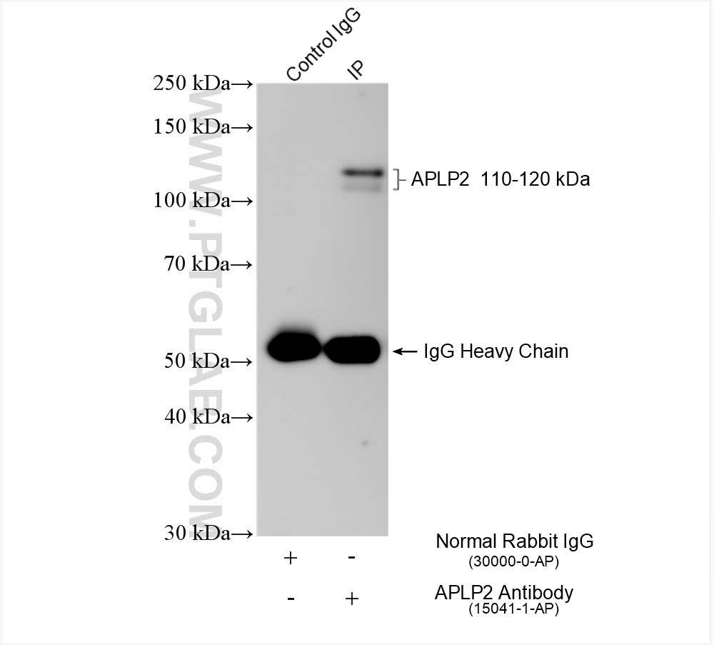 Immunoprecipitation (IP) experiment of mouse brain tissue using APLP2 Polyclonal antibody (15041-1-AP)