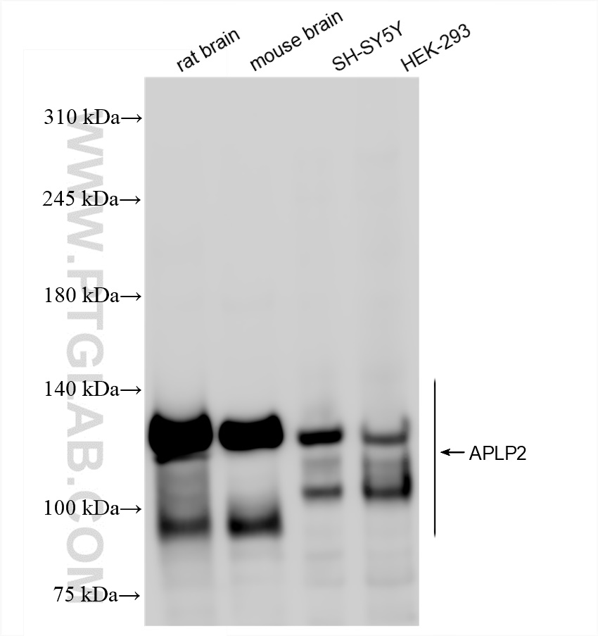 Western Blot (WB) analysis of various lysates using APLP2 Recombinant antibody (84703-3-RR)