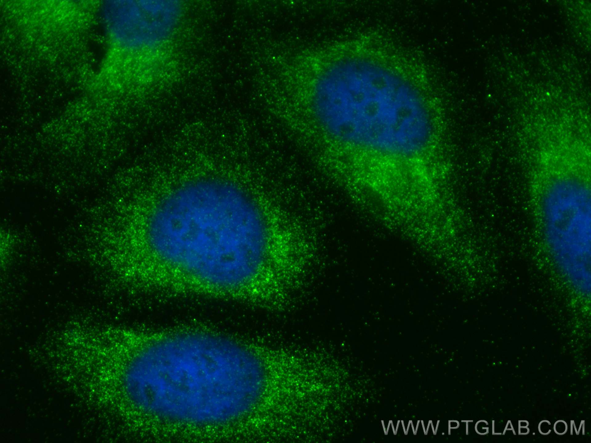 Immunofluorescence (IF) / fluorescent staining of HeLa cells using Apolipoprotein AI Polyclonal antibody (14427-1-AP)