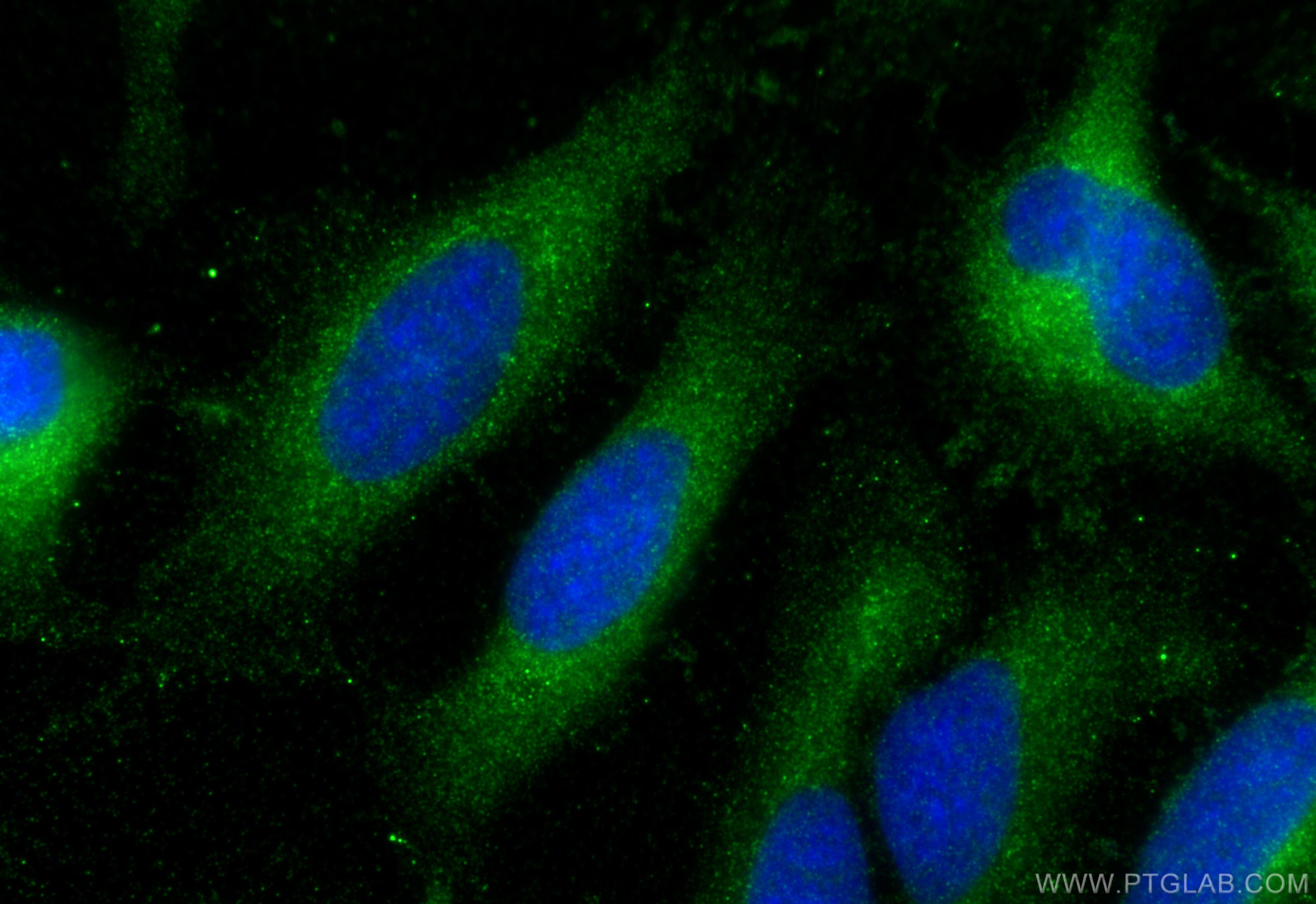 Immunofluorescence (IF) / fluorescent staining of HeLa cells using APOA1 Polyclonal antibody (31265-1-AP)