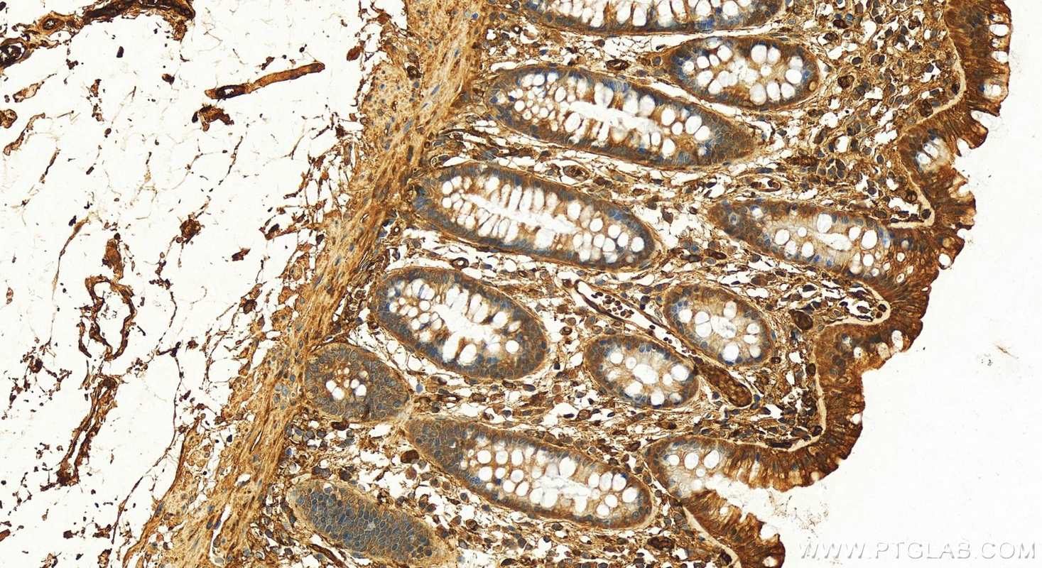 Immunohistochemistry (IHC) staining of human colon tissue using Apolipoprotein A II/APOA2 Polyclonal antibody (16845-1-AP)