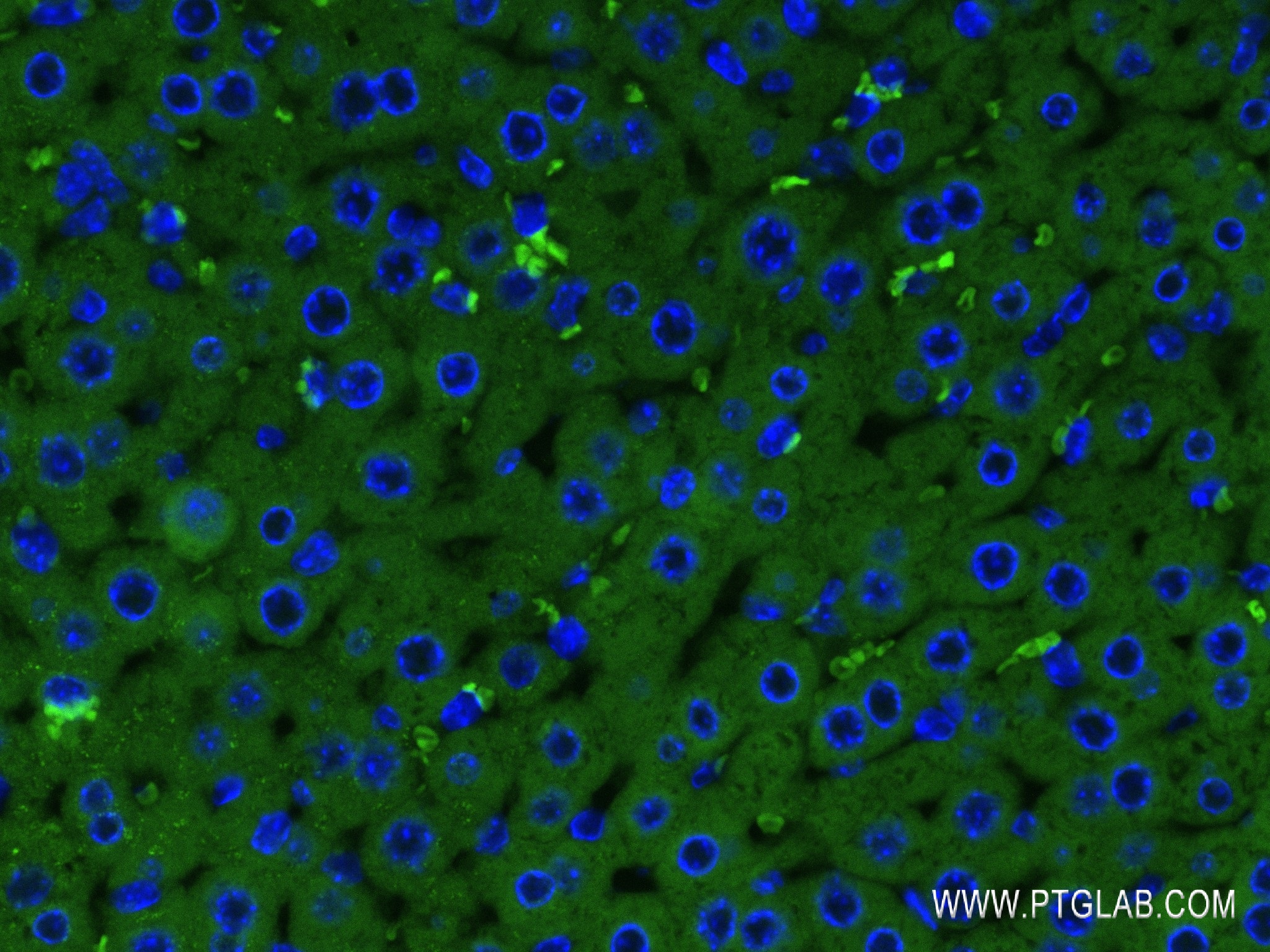 Immunofluorescence (IF) / fluorescent staining of mouse liver tissue using APOB Recombinant antibody (84047-1-RR)