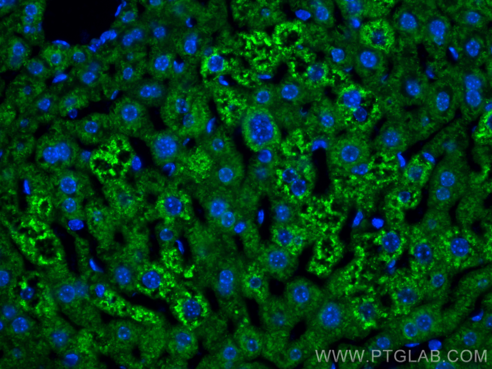 Immunofluorescence (IF) / fluorescent staining of mouse liver tissue using APOB Recombinant antibody (84047-1-RR)