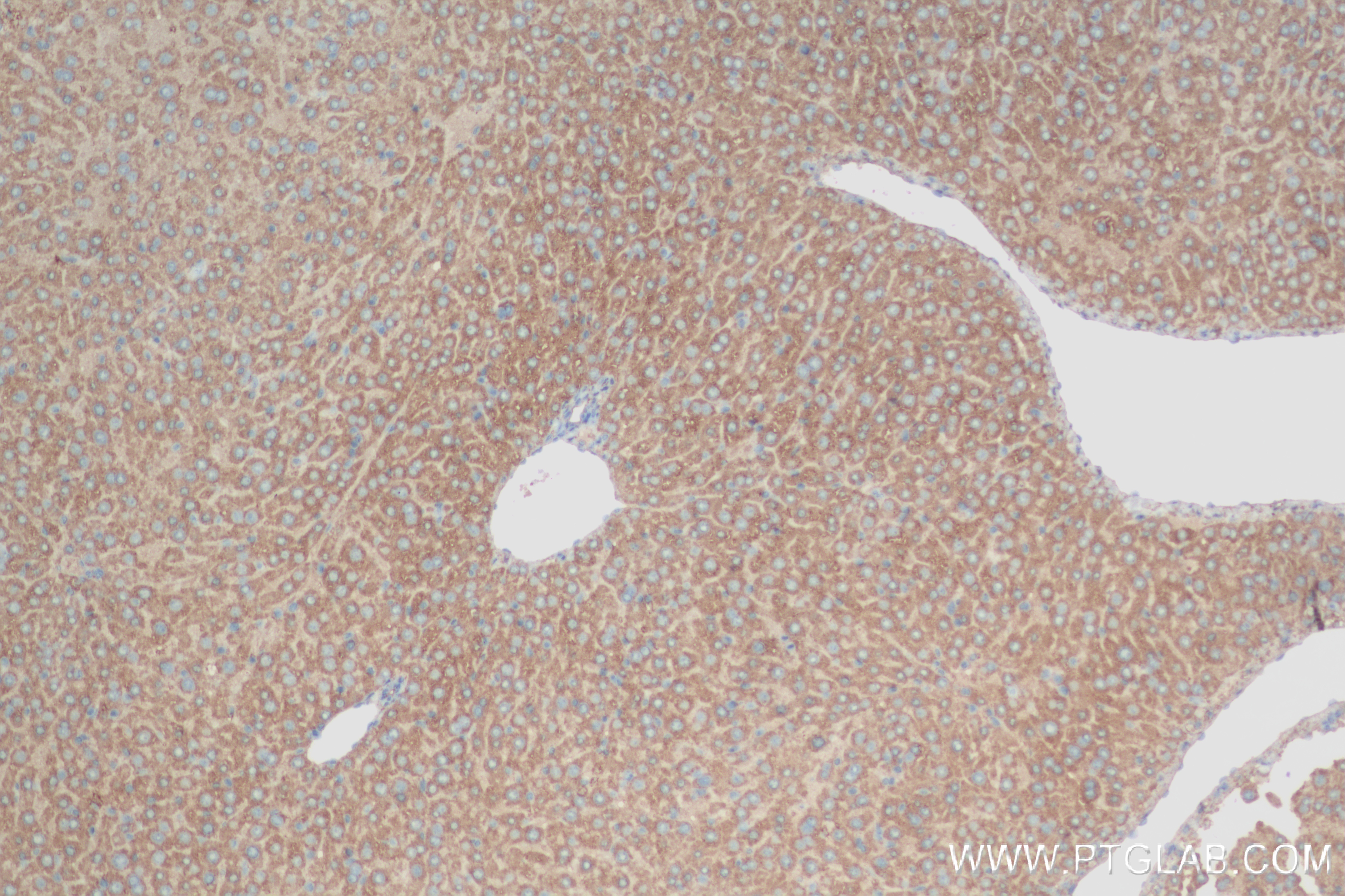 Immunohistochemistry (IHC) staining of mouse liver tissue using APOB Recombinant antibody (84047-1-RR)