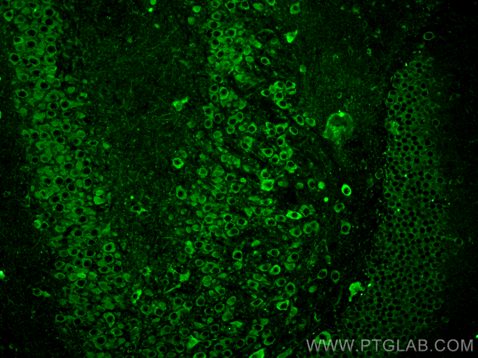 Immunofluorescence (IF) / fluorescent staining of mouse brain tissue using APOE Monoclonal antibody (66830-1-Ig)