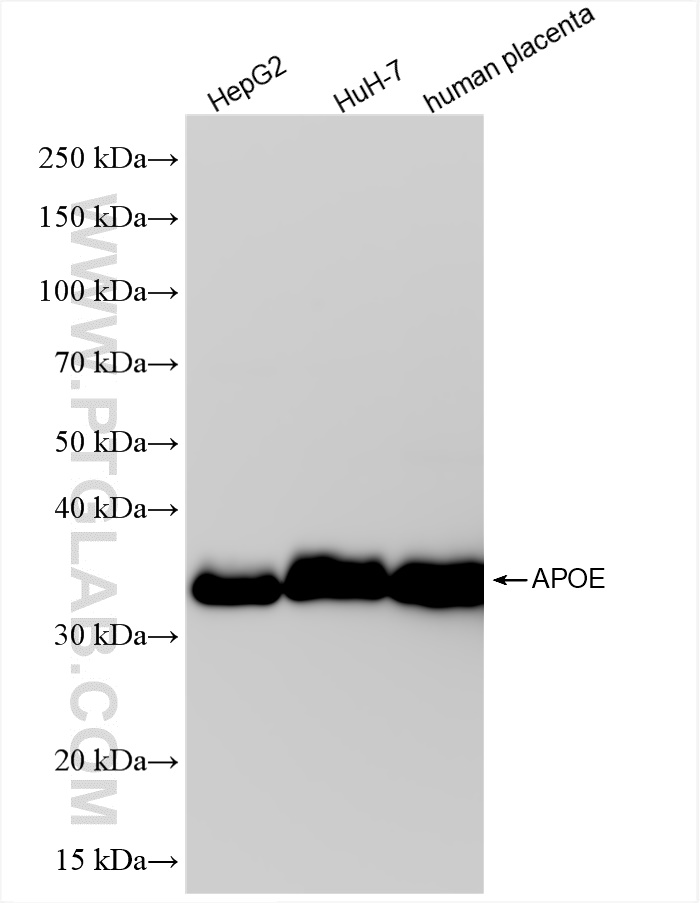 Western Blot (WB) analysis of various lysates using APOE Recombinant antibody (84775-6-RR)