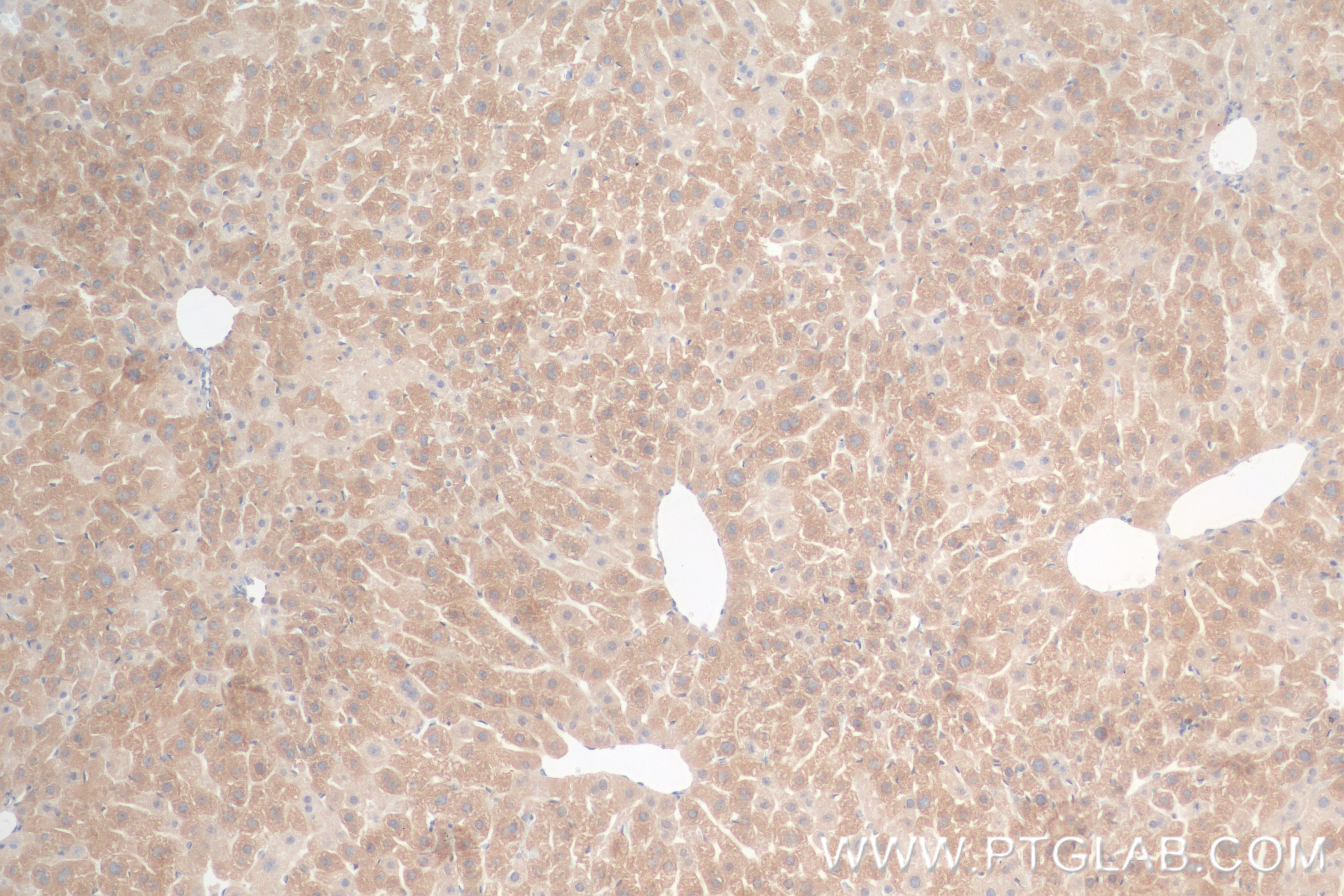 Immunohistochemistry (IHC) staining of mouse liver tissue using APOE Recombinant antibody (84775-7-RR)