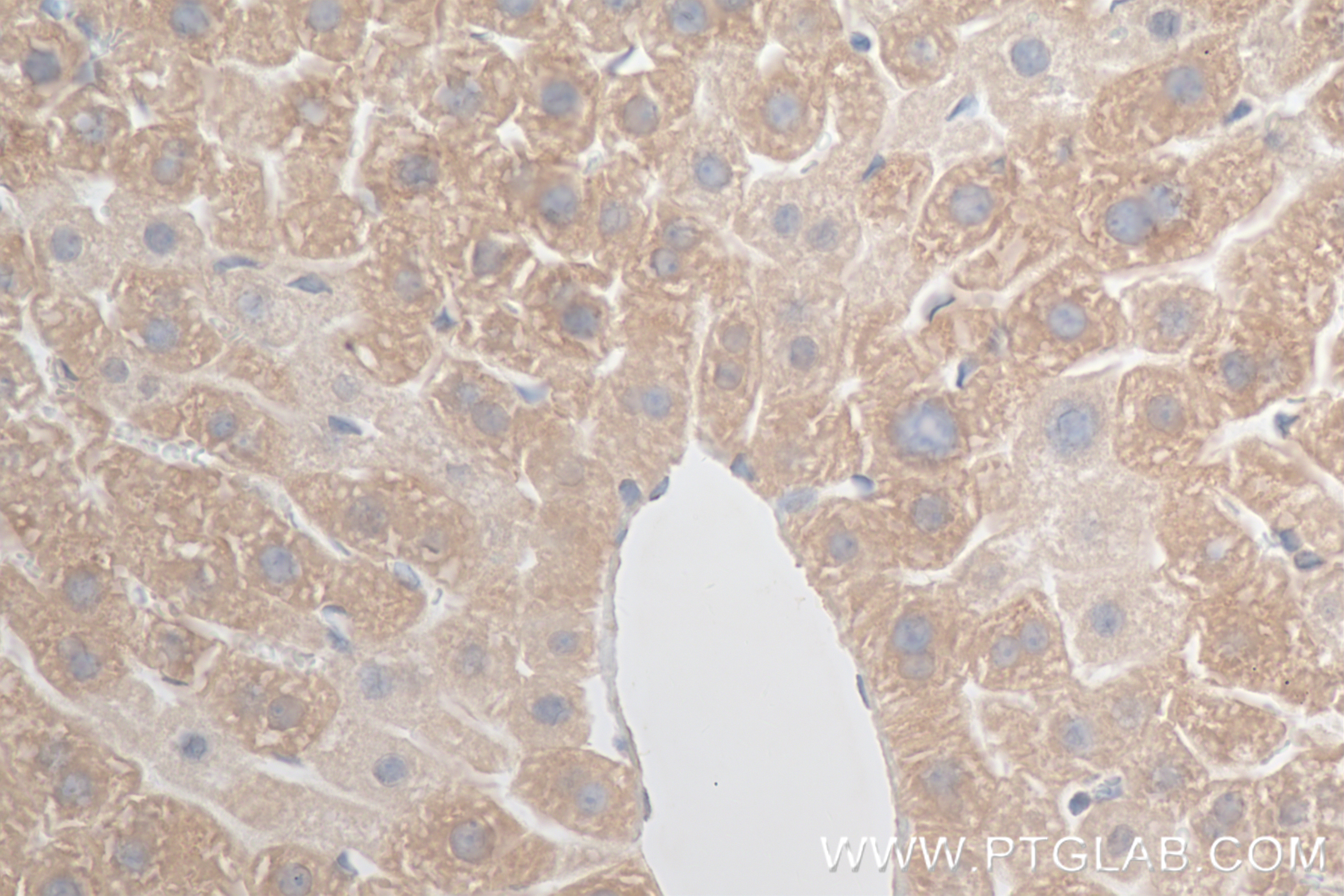 Immunohistochemistry (IHC) staining of mouse liver tissue using APOE Recombinant antibody (84775-7-RR)