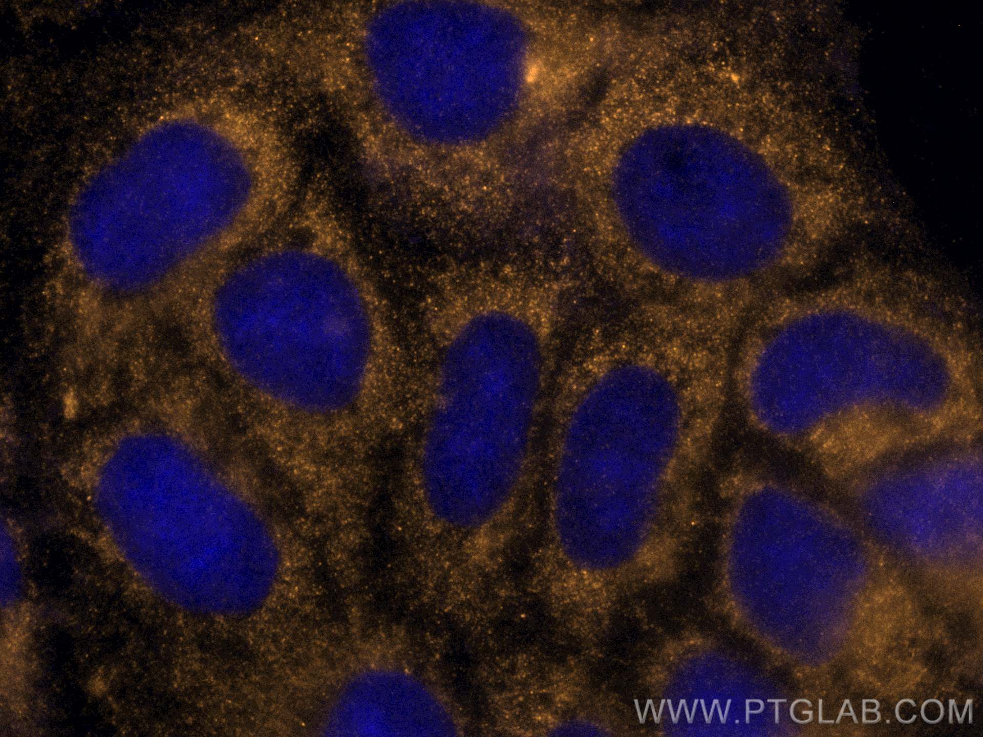 Immunofluorescence (IF) / fluorescent staining of Caco-2 cells using CoraLite®555-conjugated APOE Monoclonal antibody (CL555-66830)