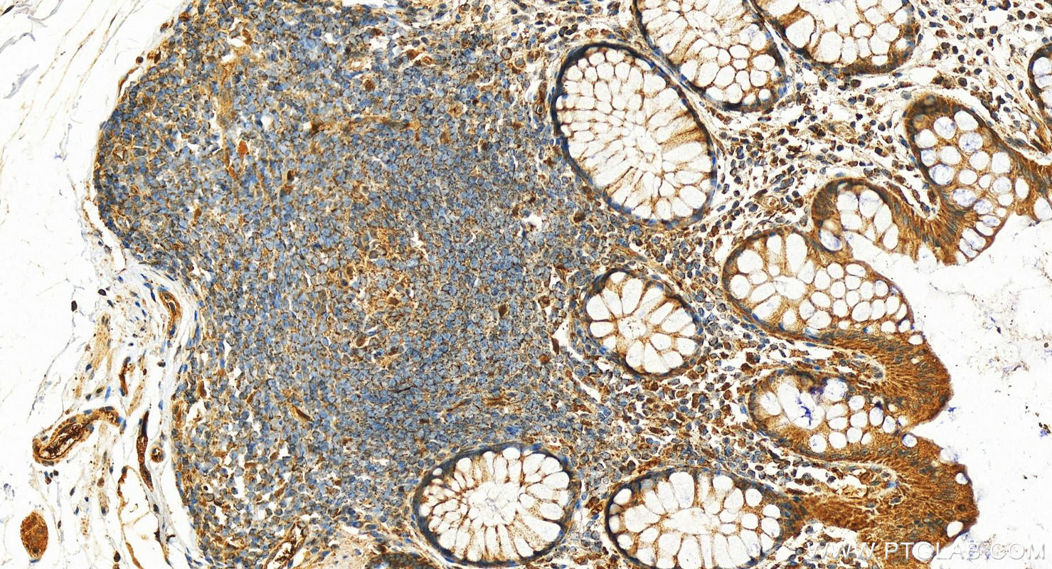 Immunohistochemistry (IHC) staining of human normal colon using Apolipoprotein H Polyclonal antibody (11892-1-AP)