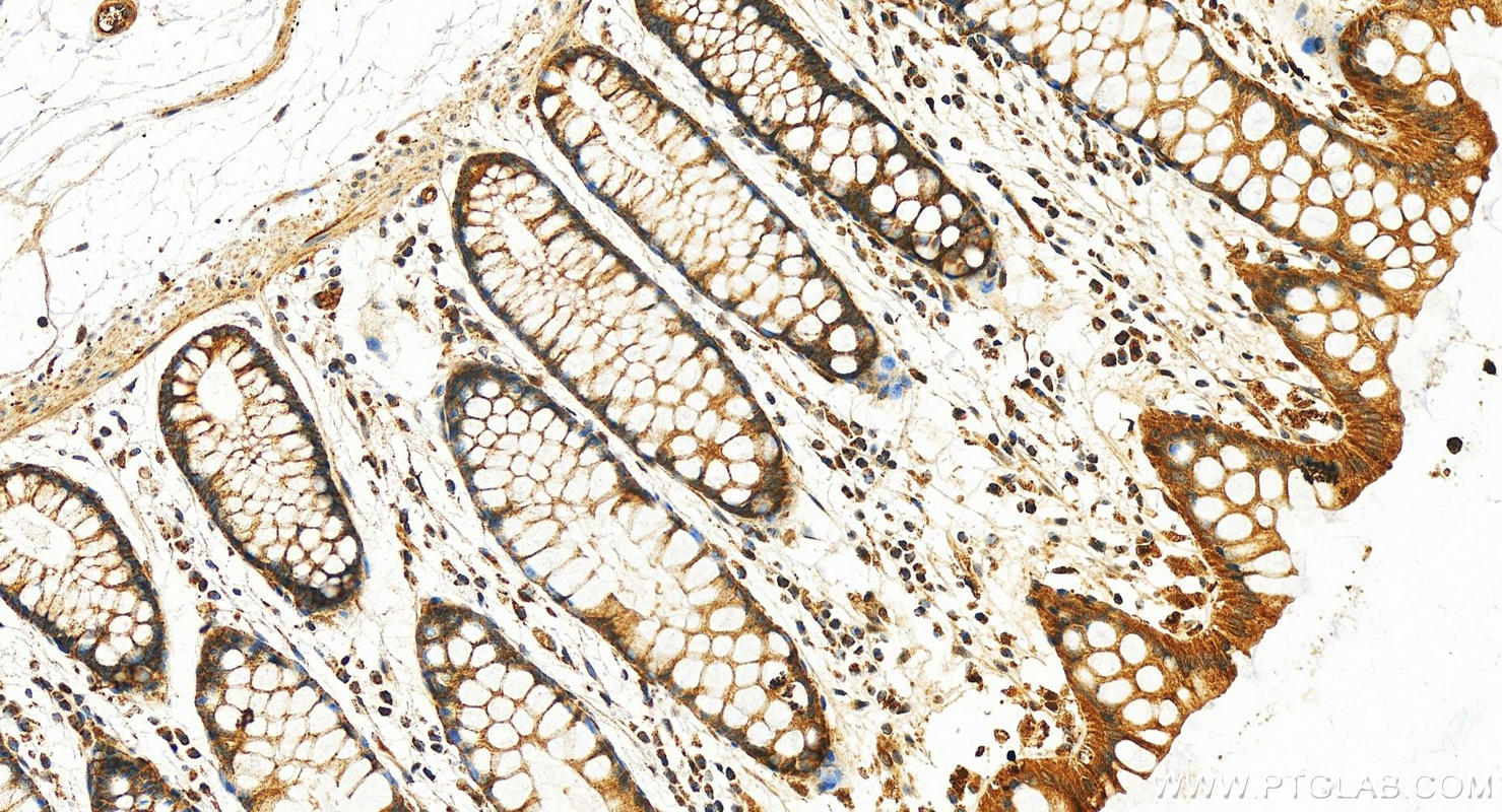 Immunohistochemistry (IHC) staining of human normal colon using Apolipoprotein H Polyclonal antibody (11892-1-AP)