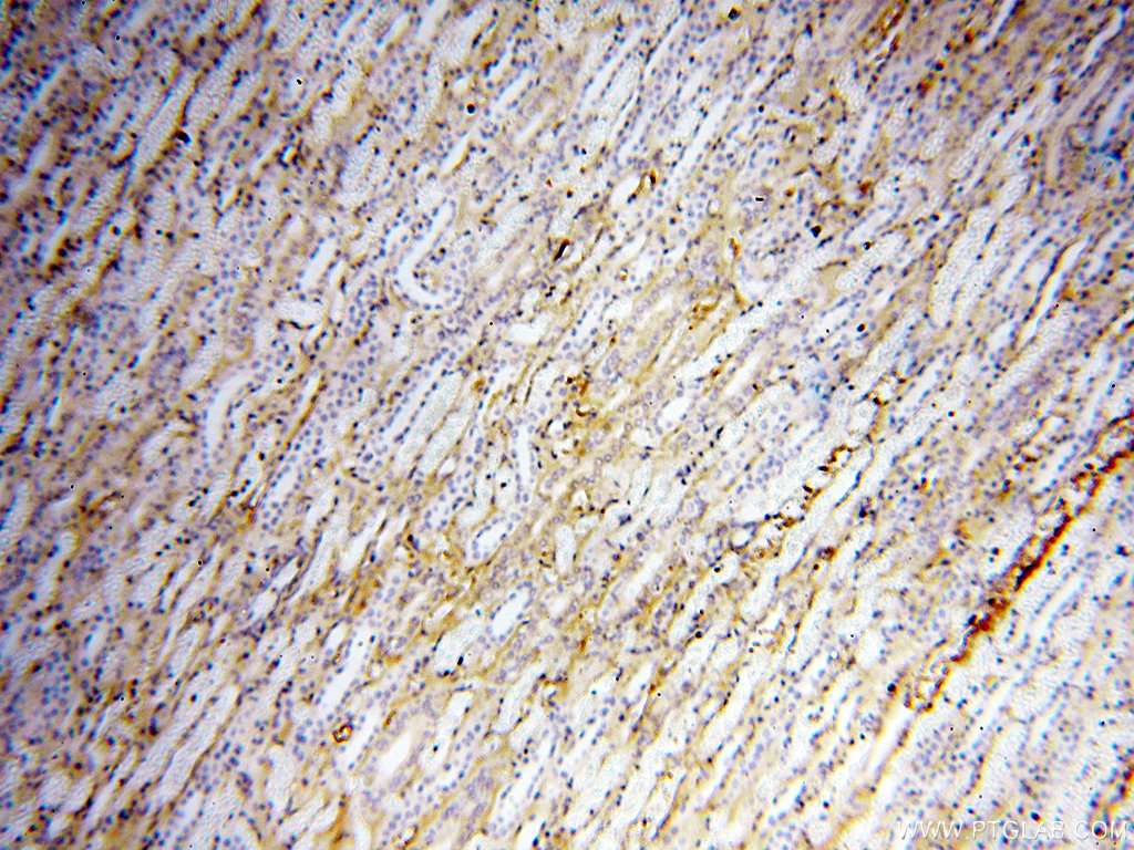 Immunohistochemistry (IHC) staining of human kidney tissue using APOL1 Polyclonal antibody (11486-2-AP)