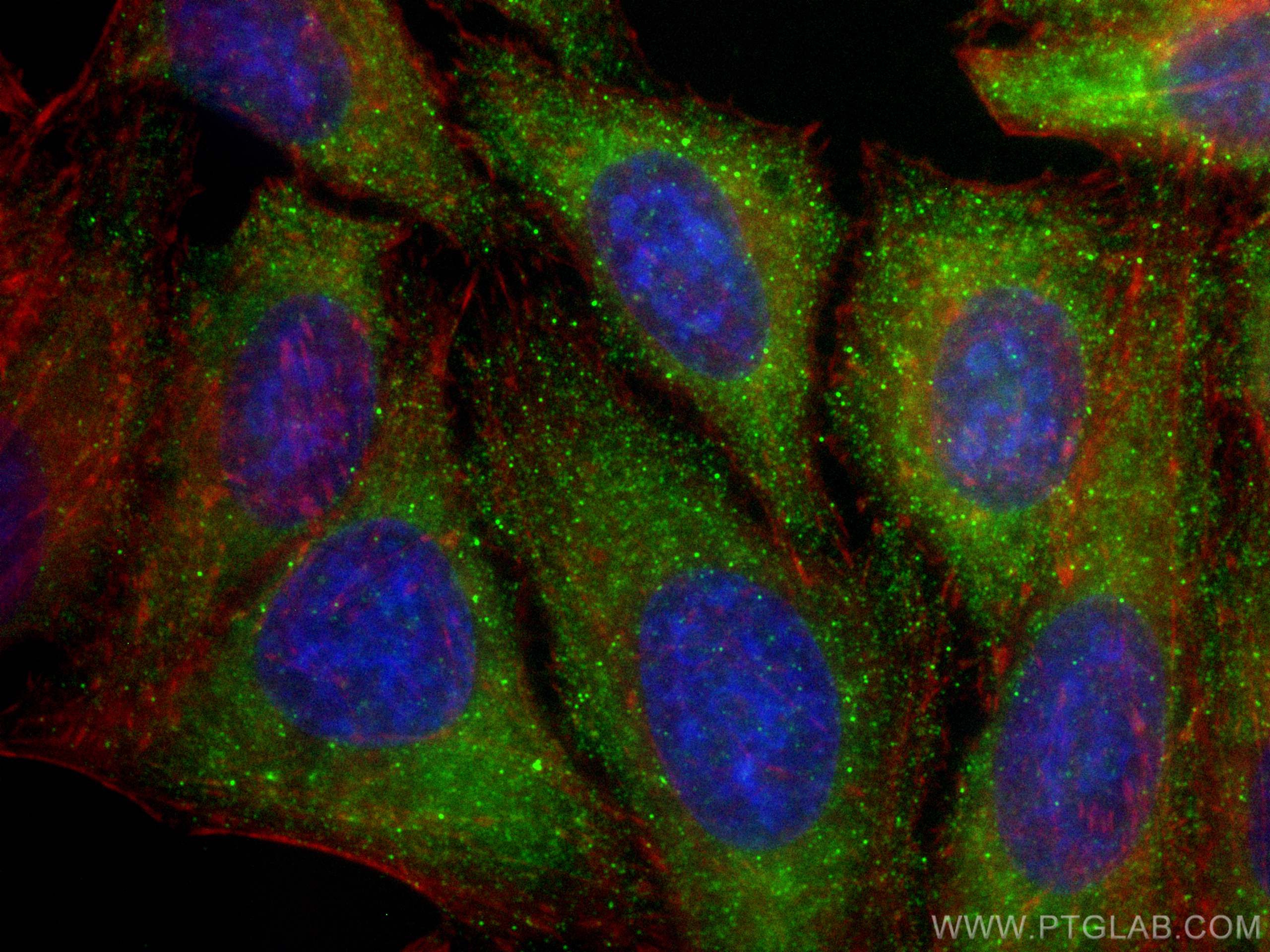 Immunofluorescence (IF) / fluorescent staining of HepG2 cells using APOL1-Specific Monoclonal antibody (66124-1-Ig)