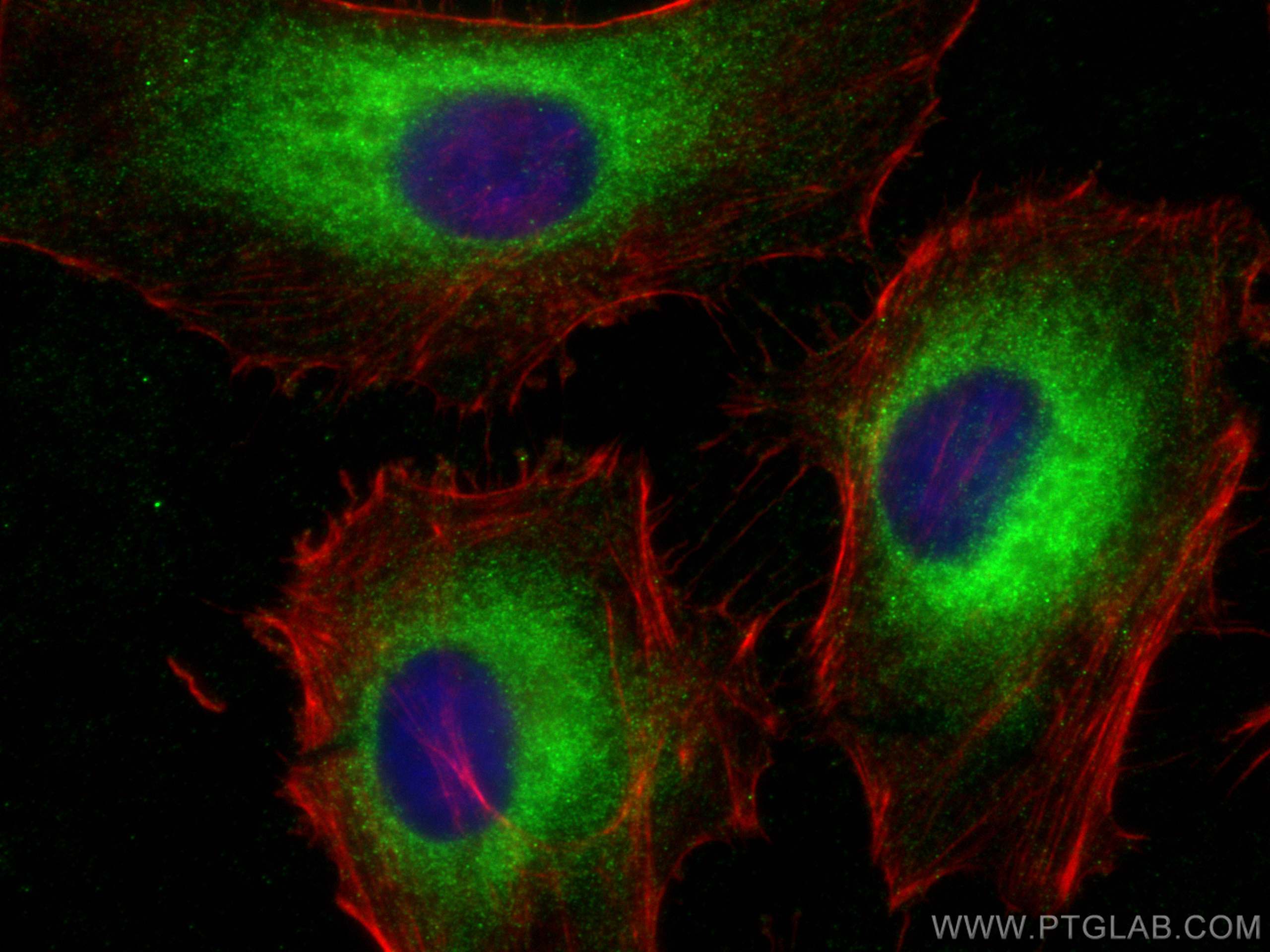 Immunofluorescence (IF) / fluorescent staining of HeLa cells using APOL2 Polyclonal antibody (25925-1-AP)