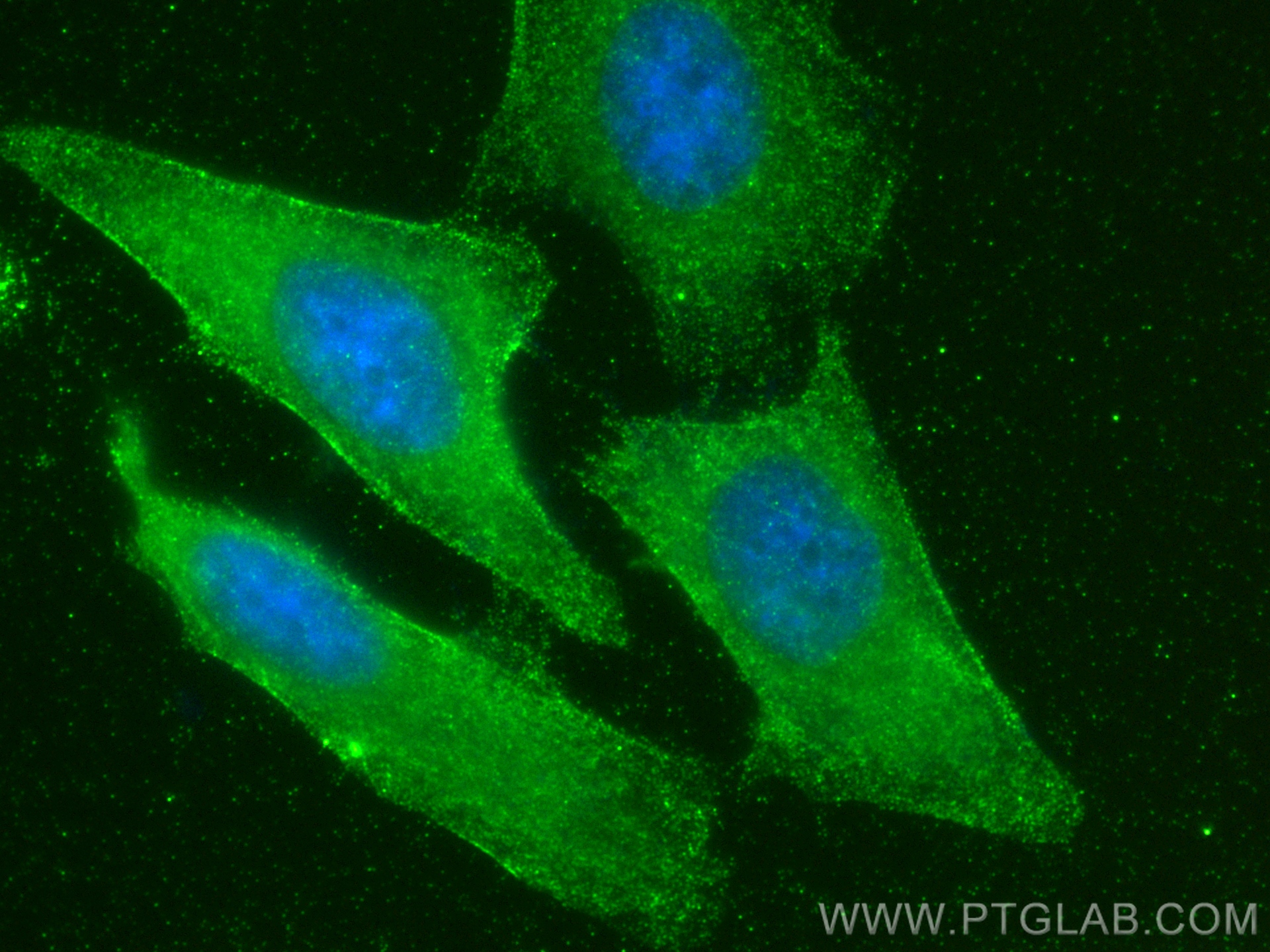 Immunofluorescence (IF) / fluorescent staining of HeLa cells using APOL6 Recombinant antibody (82877-2-RR)
