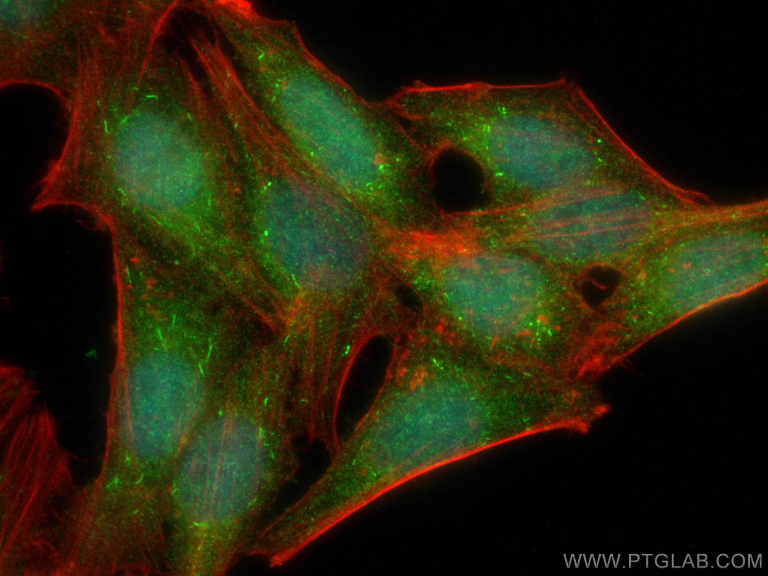 Immunofluorescence (IF) / fluorescent staining of HepG2 cells using APPL1 Polyclonal antibody (19885-1-AP)