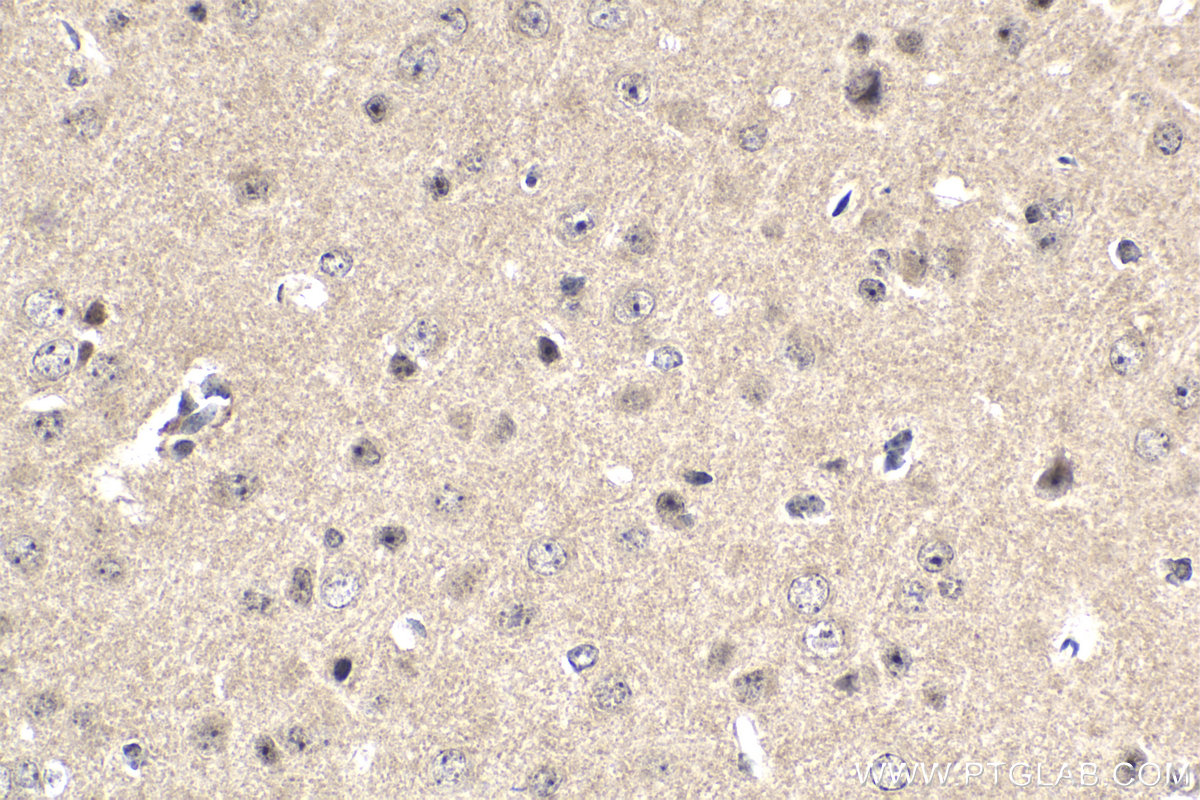 Immunohistochemistry (IHC) staining of mouse brain tissue using APPL2 Polyclonal antibody (14294-1-AP)