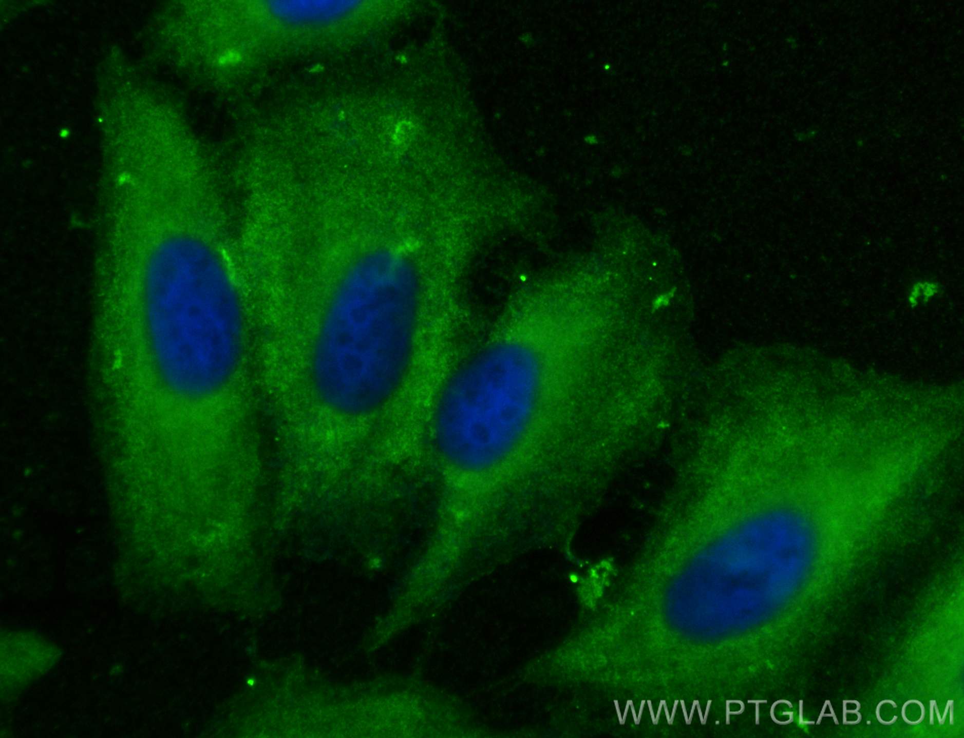 Immunofluorescence (IF) / fluorescent staining of A549 cells using APRT Polyclonal antibody (21405-1-AP)