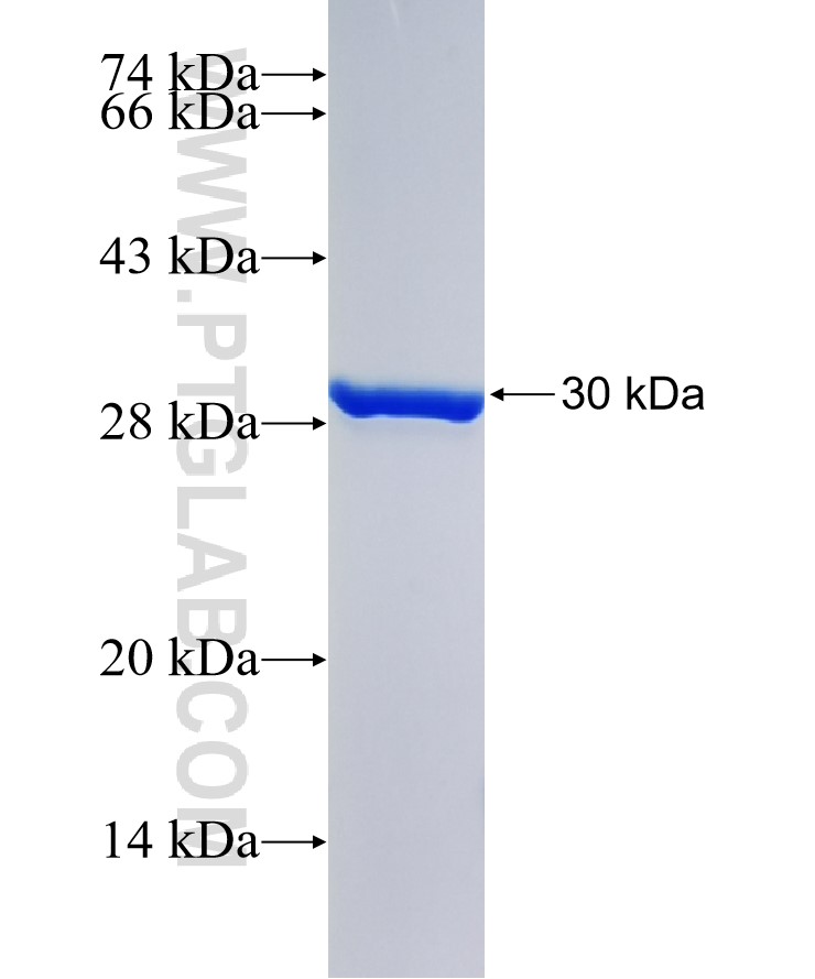 AQP3 fusion protein Ag22847 SDS-PAGE