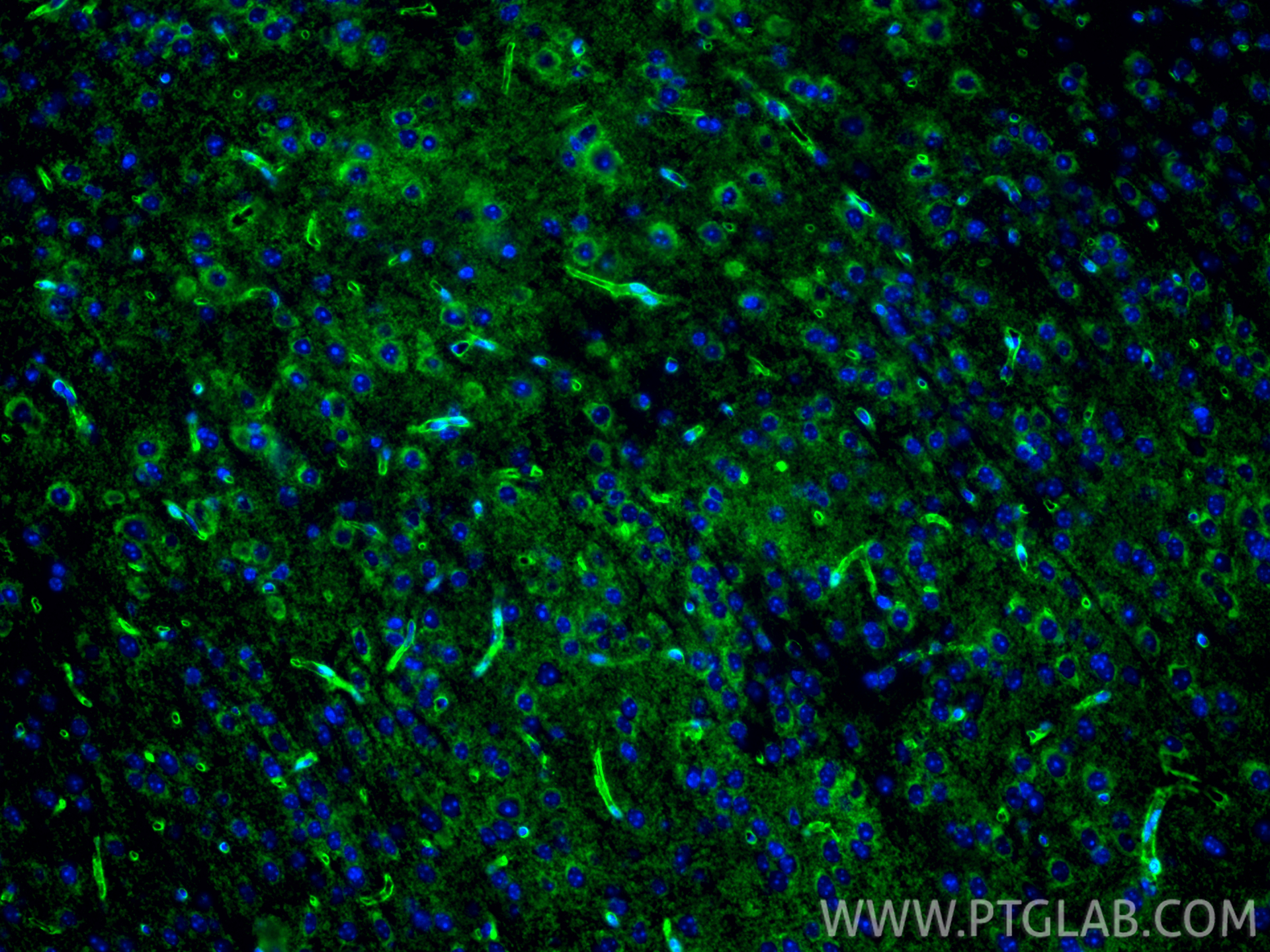 Immunofluorescence (IF) / fluorescent staining of mouse brain tissue using Aquaporin 4 Polyclonal antibody (16473-1-AP)