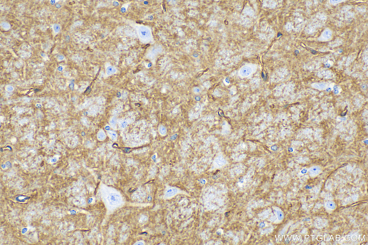 Immunohistochemistry (IHC) staining of mouse brain tissue using Aquaporin 4 Monoclonal antibody (68448-1-Ig)