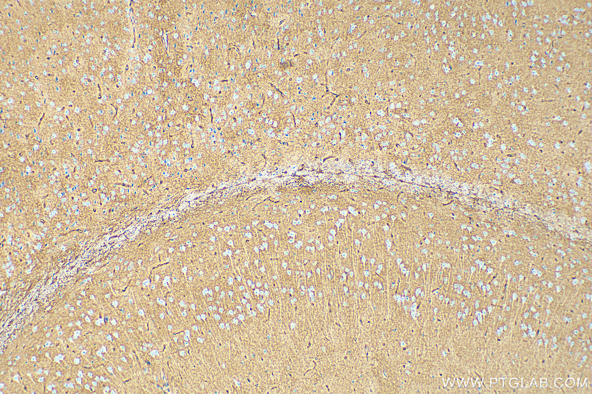 Immunohistochemistry (IHC) staining of mouse brain tissue using Aquaporin 4 Monoclonal antibody (68448-1-Ig)