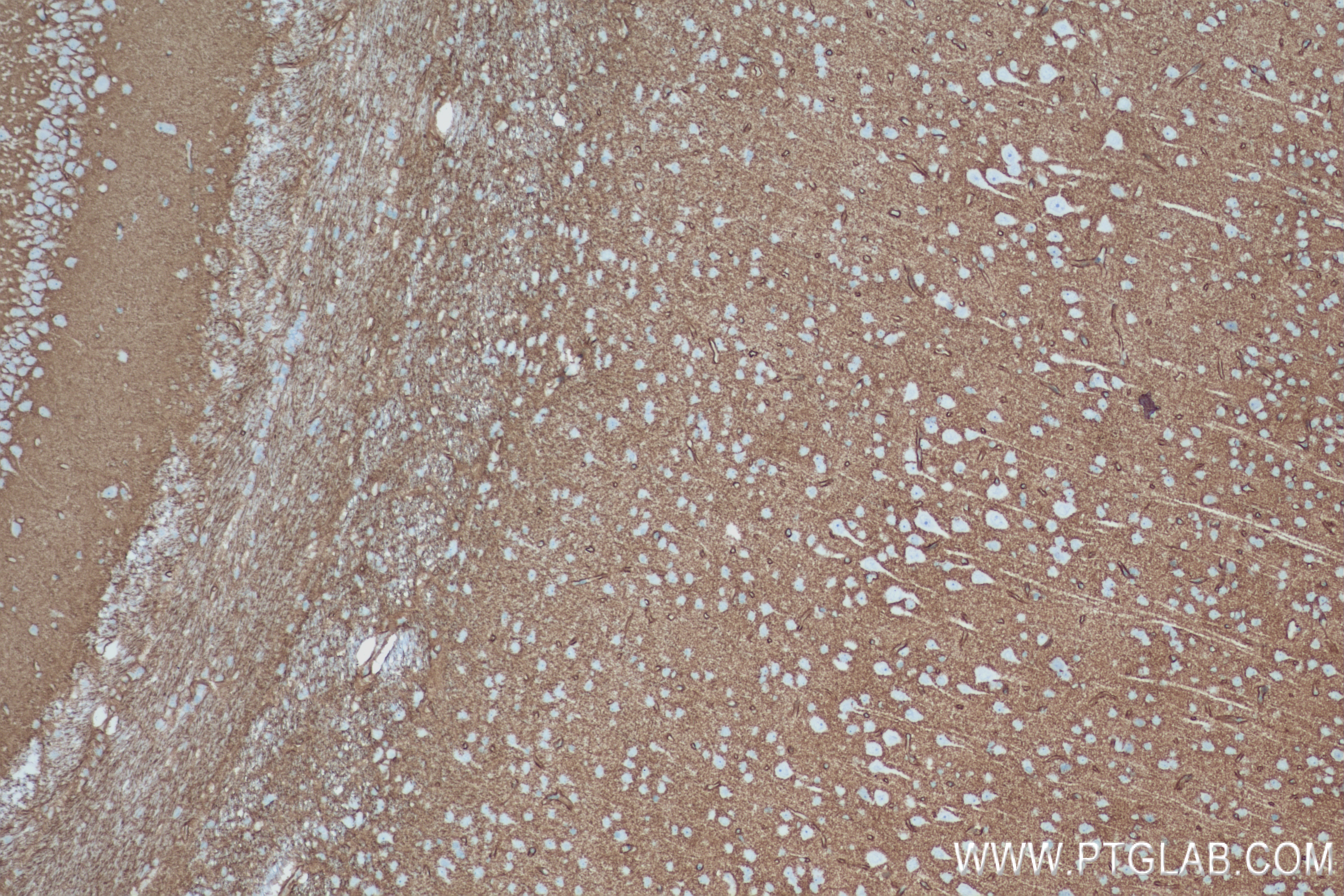 Immunohistochemistry (IHC) staining of rat brain tissue using Aquaporin 4 Recombinant antibody (82296-6-RR)