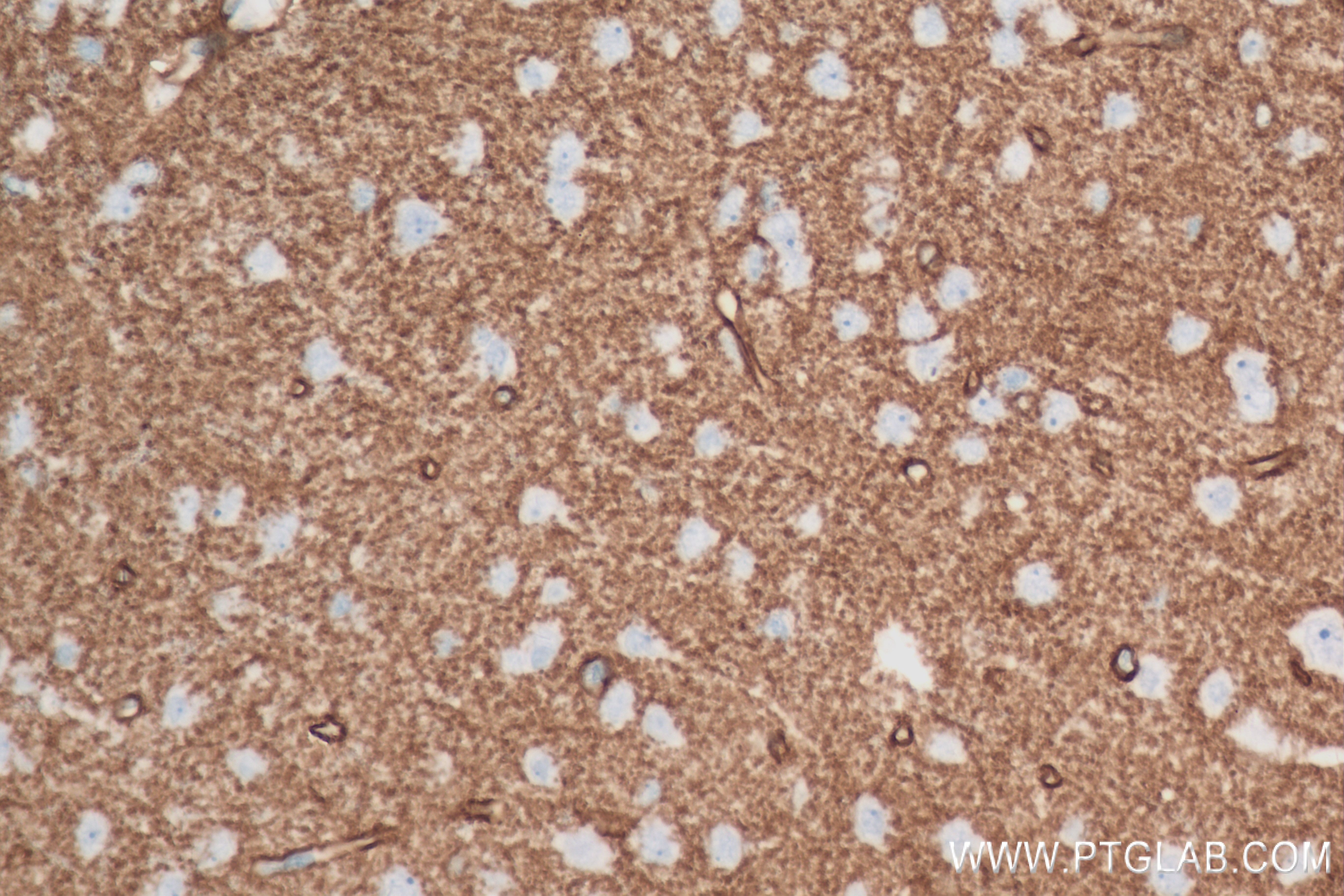 Immunohistochemistry (IHC) staining of rat brain tissue using Aquaporin 4 Recombinant antibody (82296-6-RR)