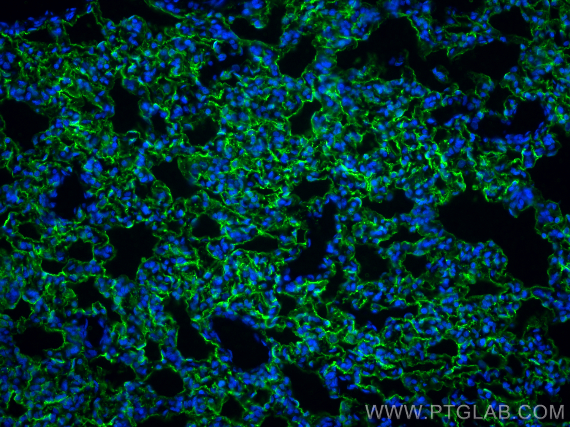 Immunofluorescence (IF) / fluorescent staining of rat lung tissue using AQP5 Polyclonal antibody (20334-1-AP)