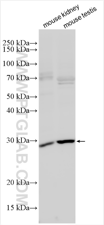 Western Blot (WB) analysis of various lysates using AQP7 Polyclonal antibody (25131-1-AP)