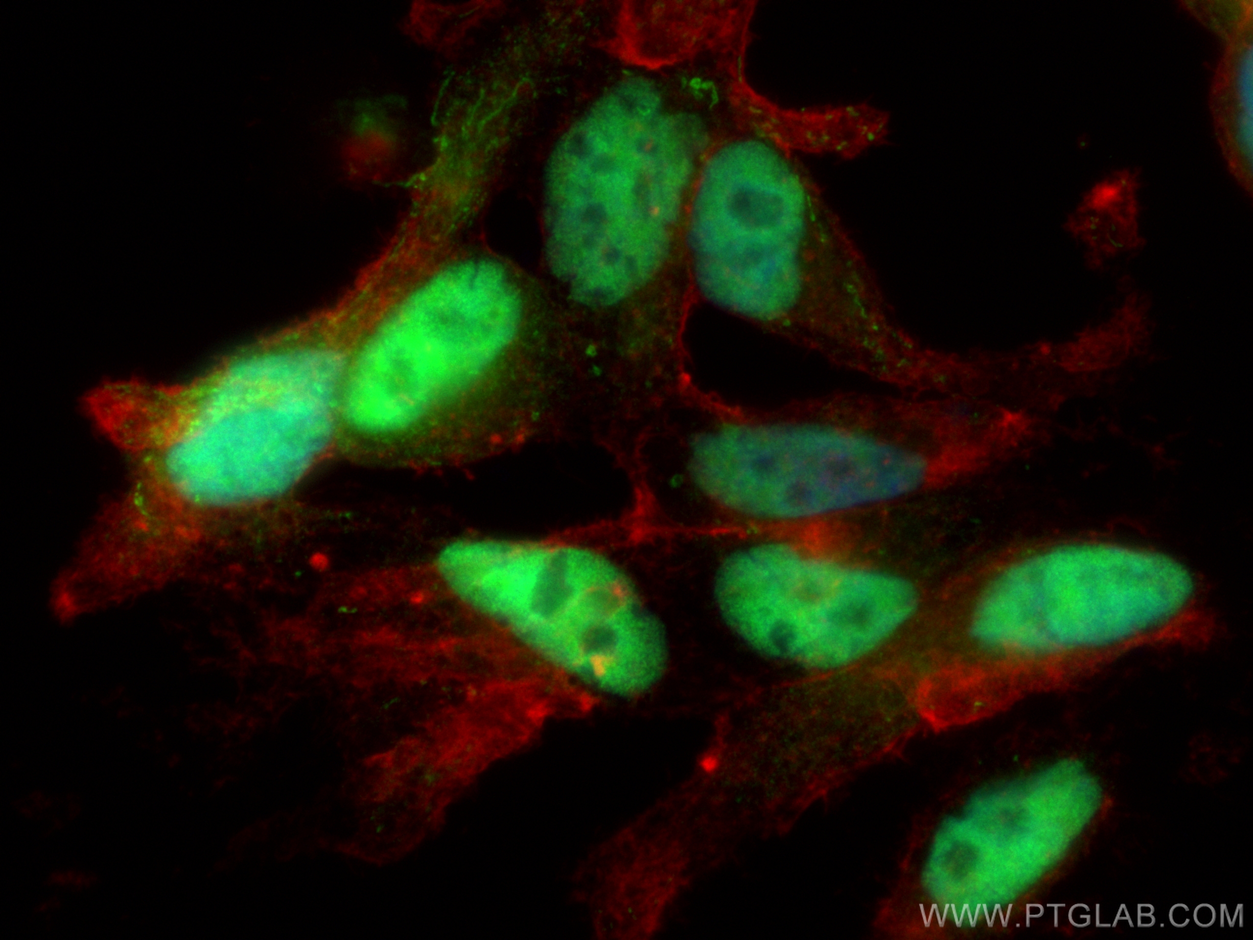 Immunofluorescence (IF) / fluorescent staining of LNCaP cells using androgen receptor Polyclonal antibody (22089-1-AP)