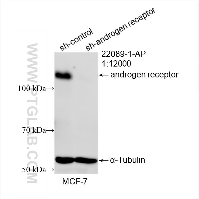 Western Blot (WB) analysis of MCF-7 cells using androgen receptor Polyclonal antibody (22089-1-AP)