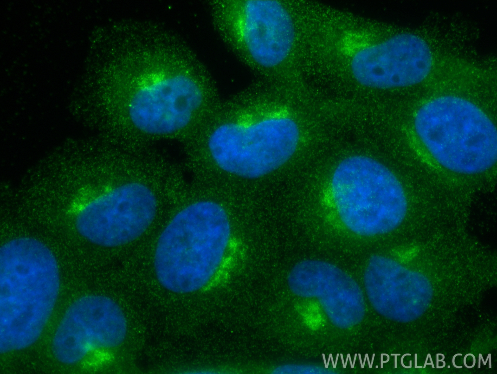 Immunofluorescence (IF) / fluorescent staining of A431 cells using ARF1 Monoclonal antibody (68069-1-Ig)
