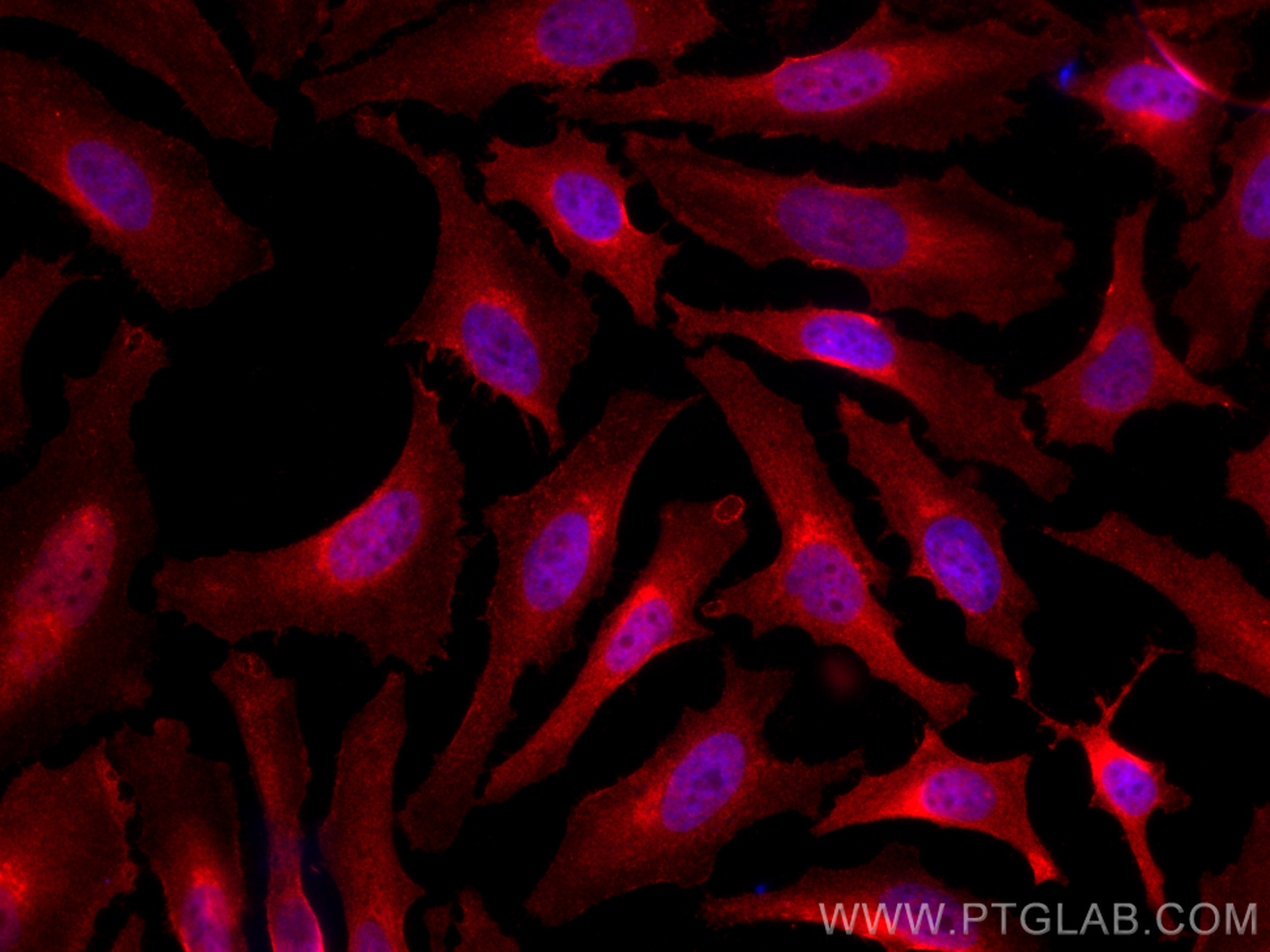 Immunofluorescence (IF) / fluorescent staining of HeLa cells using CoraLite®594-conjugated ARF1 Monoclonal antibody (CL594-68069)
