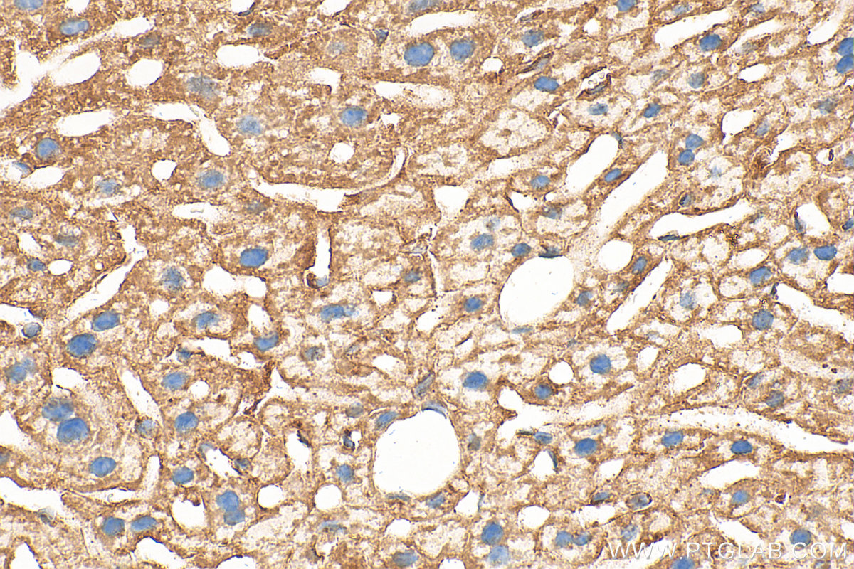 Immunohistochemistry (IHC) staining of mouse liver tissue using ARF1 Polyclonal antibody (20226-1-AP)