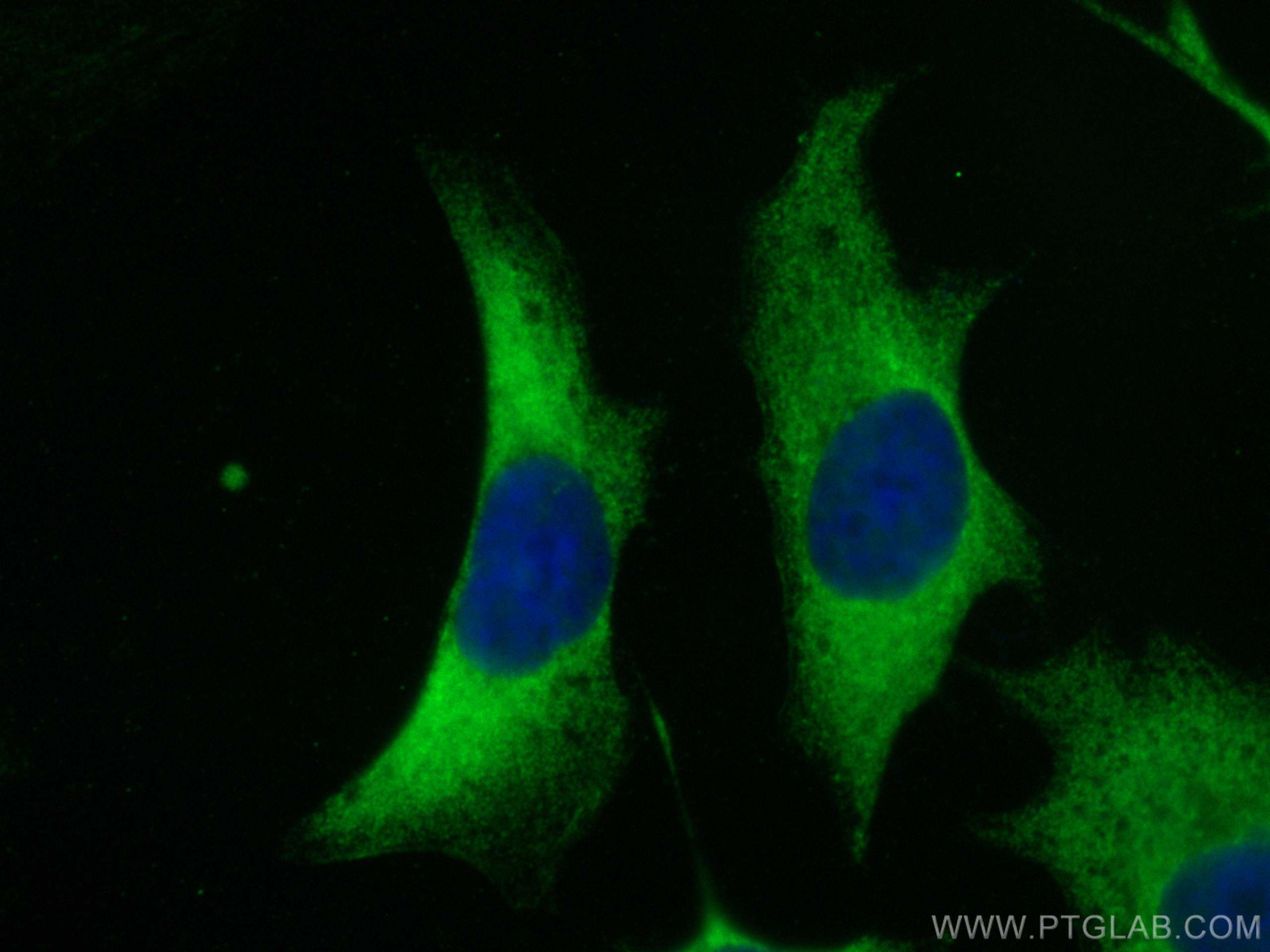 Immunofluorescence (IF) / fluorescent staining of HeLa cells using ARF3 Polyclonal antibody (22289-1-AP)