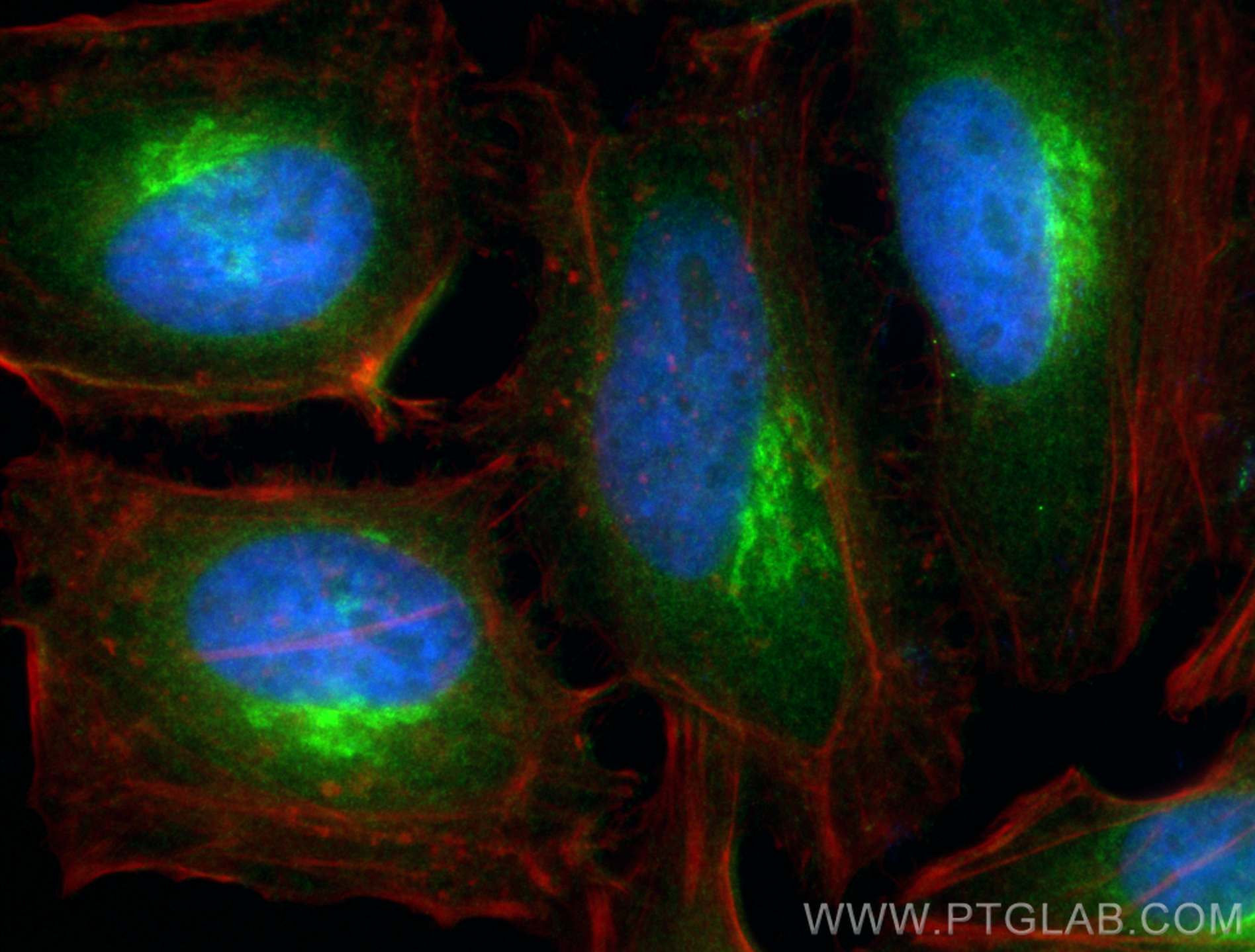 Immunofluorescence (IF) / fluorescent staining of HeLa cells using ARF4 Polyclonal antibody (11673-1-AP)