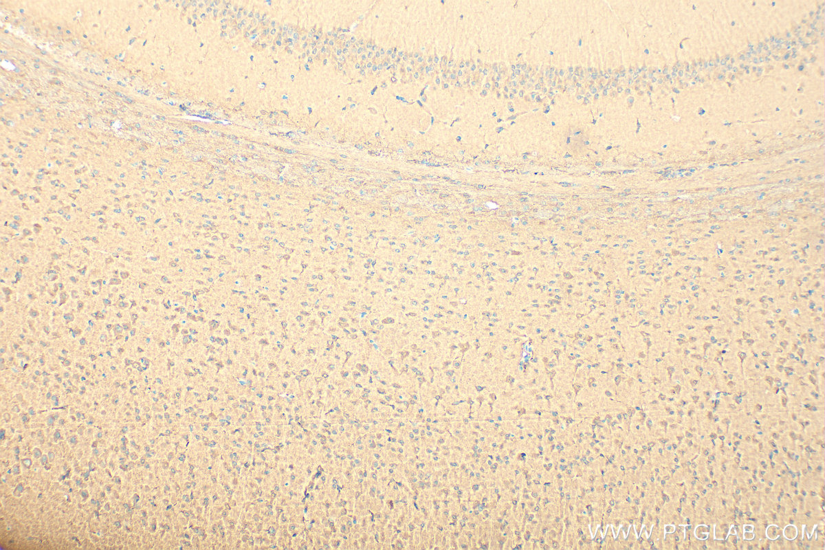 Immunohistochemistry (IHC) staining of mouse brain tissue using ARF4 Polyclonal antibody (11673-1-AP)