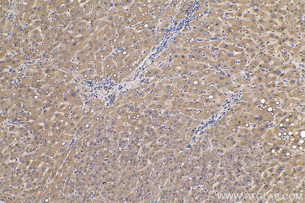 Immunohistochemistry (IHC) staining of human liver tissue using ARF4 Monoclonal antibody (68204-1-Ig)