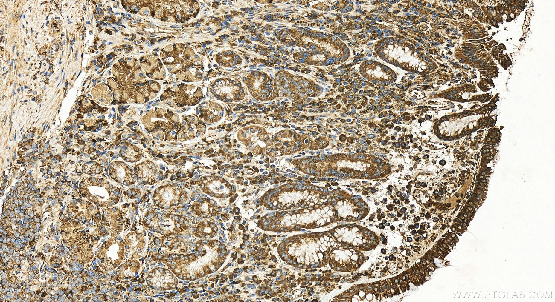 Immunohistochemistry (IHC) staining of human stomach tissue using ARF5-Specific Polyclonal antibody (20227-1-AP)