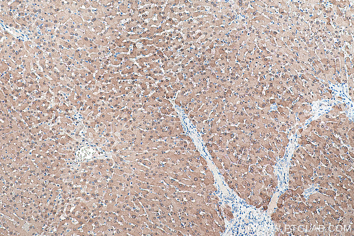 Immunohistochemistry (IHC) staining of human liver tissue using Arginase-1 Monoclonal antibody (66129-1-Ig)