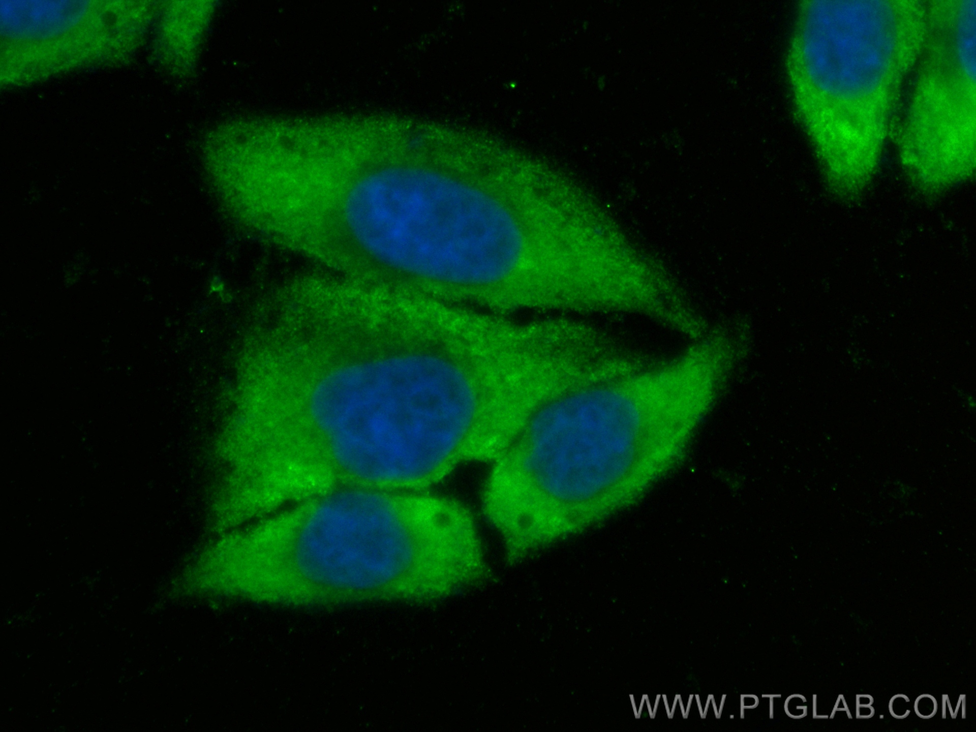 Immunofluorescence (IF) / fluorescent staining of HepG2 cells using CoraLite® Plus 488-conjugated Arginase-1 Polyclona (CL488-16001)