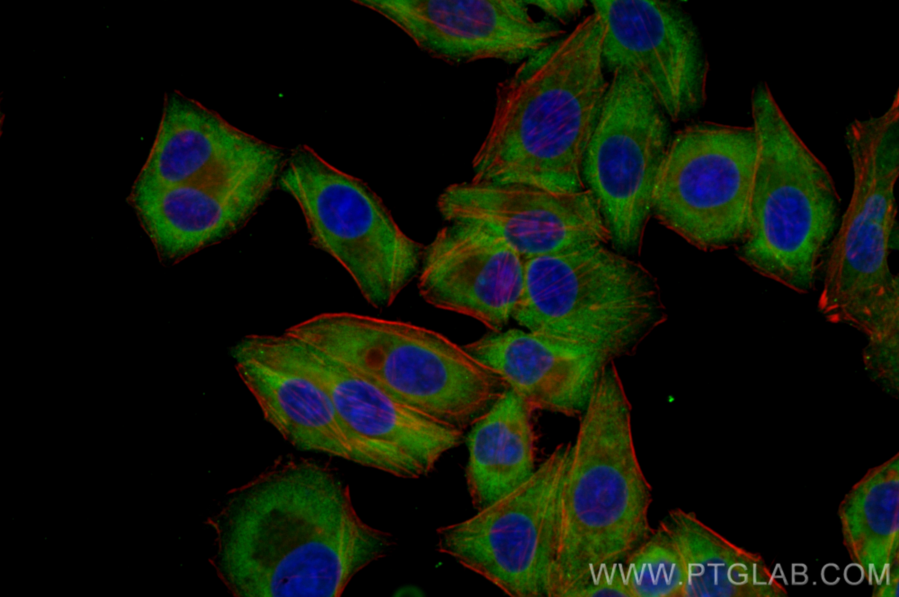 Immunofluorescence (IF) / fluorescent staining of HepG2 cells using CoraLite® Plus 488-conjugated Arginase-1 Monoclona (CL488-66129)