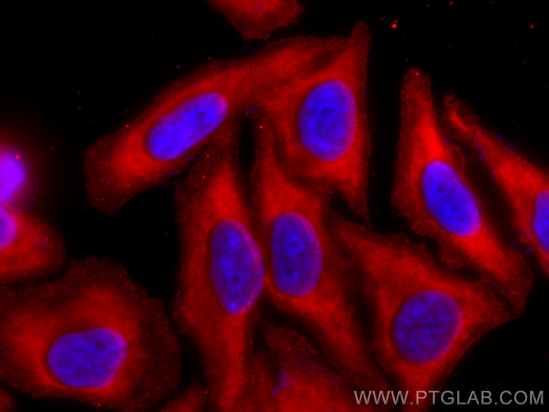 Immunofluorescence (IF) / fluorescent staining of HepG2 cells using CoraLite®594-conjugated Arginase-1 Monoclonal anti (CL594-66129)