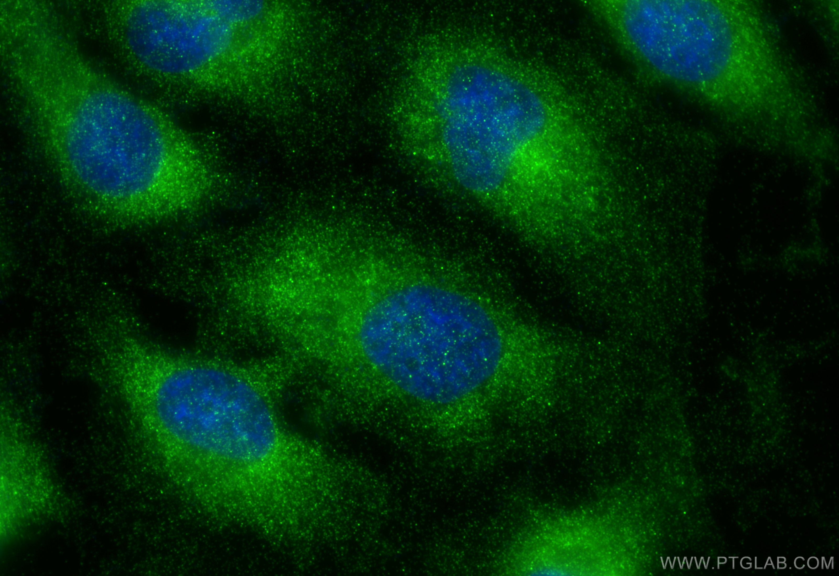 Immunofluorescence (IF) / fluorescent staining of HeLa cells using ARHGAP1 Polyclonal antibody (11169-1-AP)