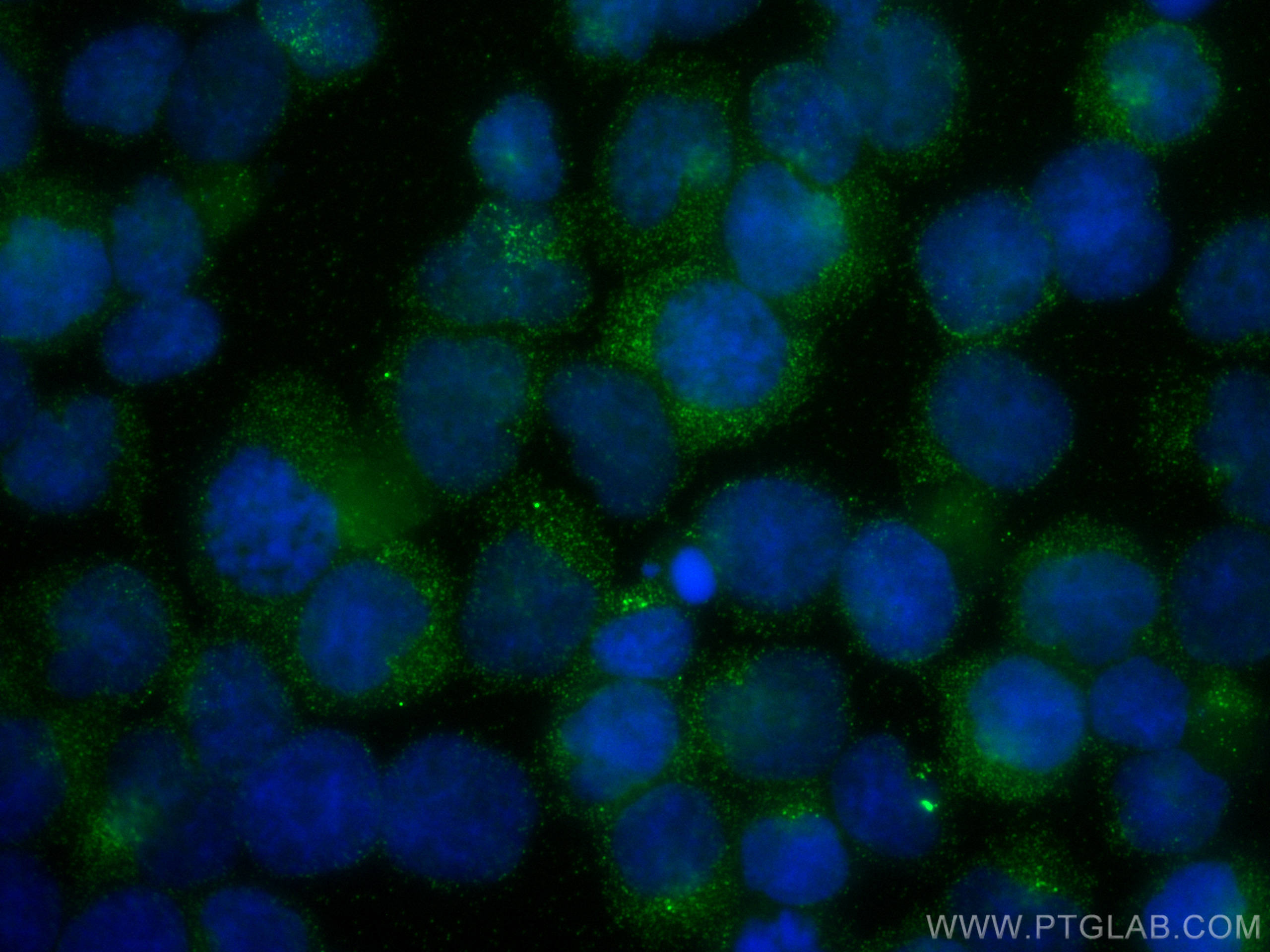 Immunofluorescence (IF) / fluorescent staining of Jurkat cells using ARHGAP15 Polyclonal antibody (11940-1-AP)