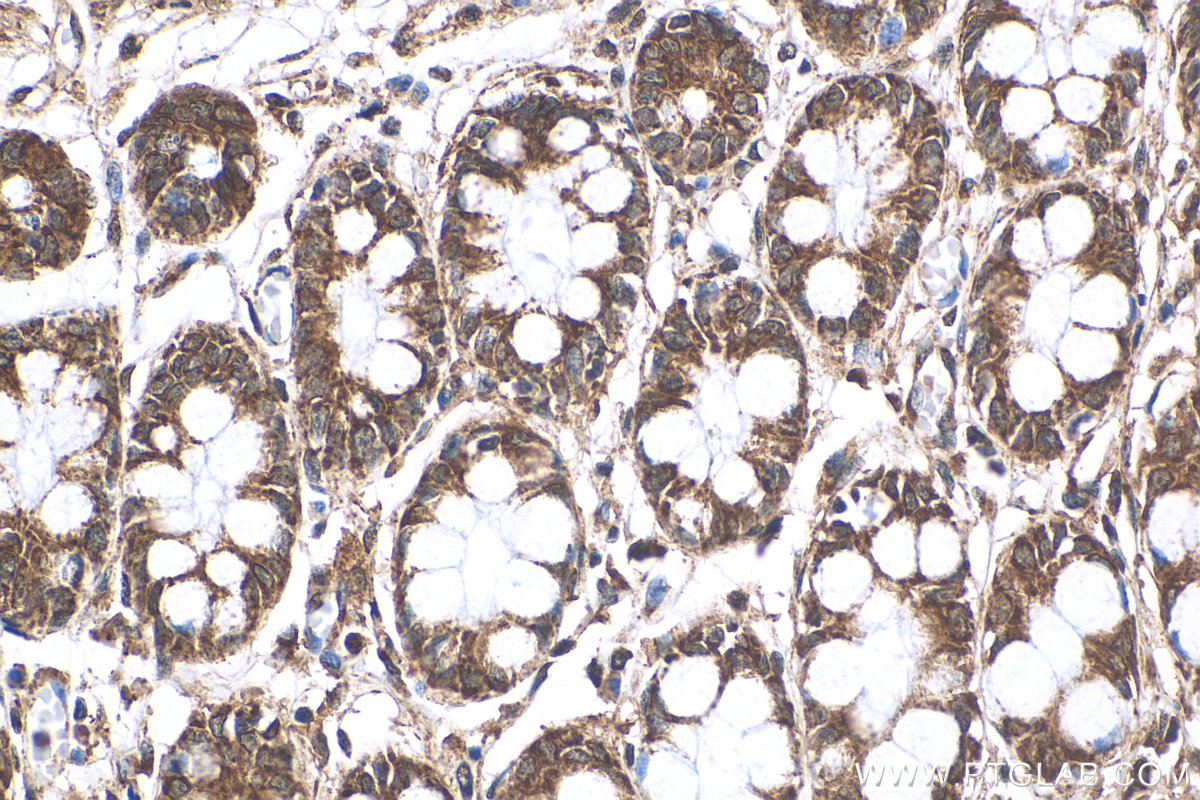 Immunohistochemistry (IHC) staining of human colon tissue using ARHGAP15 Polyclonal antibody (11940-1-AP)